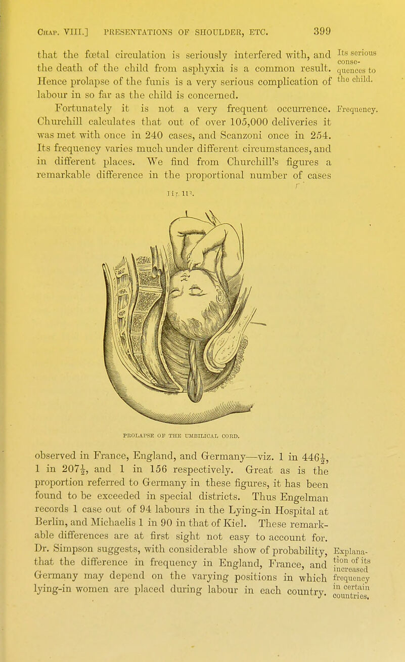 t hat the foetal circulation is seriously interfered with, and Its serious the death of the child from asphyxia is a common result. quciiccs to Hence prolapse of the funis is a very serious complication of tn0 chl111- labour in so far as the child is concerned. Fortunately it is not a very frequent occurrence. Frequency. Churchill calculates that out of over 105,000 deliveries it was met with once in 240 cases, and Scanzoni once in 254. Its frequency varies much under different circumstances, and in different places. We find from Churchill's figures a remarkable difference in the proportional number of cases 1 i r If. PIlOLArSE OP THE UMBILICAL CORD. observed in France, England, and Germany—viz. 1 in 446^, 1 in 207^, and 1 in 156 respectively. Great as is the proportion referred to Germany in these figures, it has been found to be exceeded in special districts. Thus Engelman records 1 case out of 94 labours in the Lying-in Hospital at Berlin, and Michaelis 1 in 90 in that of Kiel. These remark- able differences are at first sight not easy to account for. Dr. Simpson suggests, with considerable show of probability, Explana- that the difference in frequency in England, France, and hicreusecf Germany may depend on the varying positions in which frequency lying-in women are placed during labour in each country. couSes