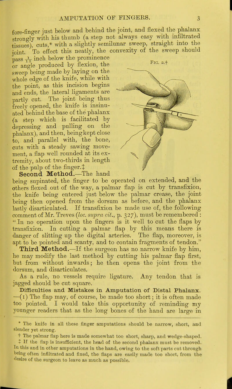 fore-finger just below and behind the joint, and flexed the phalanx strongly with his thumb (a step not always easy with infiltrated tissues), cuts* with a slightly semilunar sweep, straight into the joint. To effect this neatly, the convexity of the sweep should pass _v inch below the prominence or angle produced by flexion, the sweep being made by laying on the whole edge of the knife, while with the point, as this incision begins and ends, the lateral ligaments are partly cut. The joint being thus freely opened, the knife is insinu- ated behind the base of the phalanx (a step which is facilitated by depressing and pulling on the phalanx), and then, being kept close to, and parallel with, the bone, cuts with a steady sawing move- ment, a flap well rounded at its ex- tremity, about two-thirds in length of the pulp of the finger, t Second Method.—The hand being supinated, the finger to be operated on extended, and the others flexed out of the way, a palmar flap is cut by transfixion, the knife being entered just below the palmar crease, the joint being then opened from the dorsum as before, and the phalanx lastly disarticulated. If transfixion be made use of, the following comment of Mr. Treves (loc. supra cit., p. 327), must be remembered :  In no operation upon the fingers is it well to cut the flaps by transfixion. In catting a palmar flap by this means there is danger of slitting up the digital arteries. The flap, moreover, is apt to be pointed and scanty, and to contain fragments of tendon. Third Method.—If the surgeon has no narrow knife by him, he may modify the last method by cutting his palmar flap first, but from without inwards; he then opens the joint from the dorsum, and disarticulates. As a rule, no vessels require ligature. Any tendon that is jagged should be cut square. Difficulties and Mistakes in Amputation of Distal Phalanx. —(1) The flap may, of course, be made too short; it is often made too pointed. I would take this opportunity of reminding my younger readers that as the long bones of the hand are large in * The knife in all these finger amputations should be narrow, short, and slender yet strong. t The palmar flap here is made somewhat too short, sharp, and wedge-shaped. $ If the flap is insufficient, the head of the second phalanx must be removed. In this and in other amputations in the hand, owing to the soft parts cut through being often infiltrated and fixed, the flaps are easily made too short, from the desire of the surgeon to leave as much as possible.