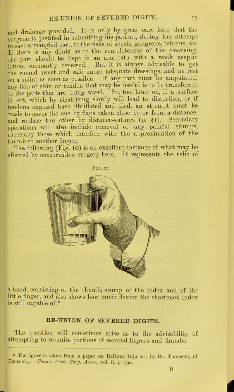 and drainage provided. It is only by great care here that the suro-eon is justified in submitting his patient, during the attempt to save a mangled part, to the risks of sepsis, gangrene, tetanus,&c. If there is any doubt as to the completeness of the cleansing, the part should be kept in an arm-bath with a weak aseptic lotion, constantly renewed. But it is always advisable to get the wound sweet and safe under adequate dressings, and at rest on a splint as soon as possible. If any part must be amputated, any flap of skin or tendon that may be useful is to be transferred to the parts that are being saved. So, too, later on, if a surface is left, which by cicatrising slowly will lead to distortion, or if tendons exposed have fibrillated and died, an attempt must be made to cover the one by flaps taken close by or from a distance, and replace the other by distance-sutures (p. 31). Secondary operations will also include removal of any painful stumps, especially those which interfere with the approximation of the thumb to another finger, The following (Fig. 10) is an excellent instance of what may be effected by conservative surgery here. It represents the relic of Fig. 10. a hand, consisting of the thumb, stump of the index and of the little finger, and also shows how much flexion the shortened index is still capable of.* RE-UNION OF SEVERED DIGITS. The question will sometimes arise as to the advisability of attempting to re-unite portions of severed fingers and thumbs. * The figure is taken from a paper on Railway Injuries, by Dr. Thomson, of Kentucky. — Trans. Amer. Surg. Ahxoc, vol. ii. p. 190.