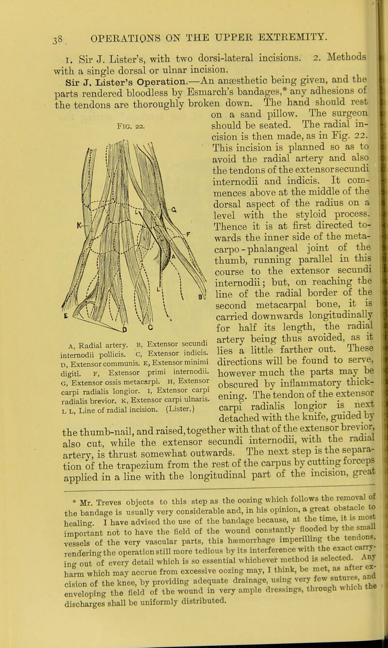 i. Sir J. Lister's, with two dorsi-lateral incisions. 2. Methods with a single dorsal or ulnar incision. Sir J. Lister's Operation.—An anaesthetic being given, and the parts rendered bloodless by Esmarch's bandages* any adhesions of the tendons are thoroughly broken down. The hand should rest on a sand pillow. The surgeon fig. 22. should be seated. The radial in- cision is then made, as in Fig. 22. This incision is planned so as to avoid the radial artery and also the tendons of the extensor secundi internodii and indicis. It com- mences above at the middle of the dorsal aspect of the radius on a level with the styloid process. Thence it is at first directed to- wards the inner side of the meta- carpo - phalangeal joint of the thumb, running parallel in this course to the extensor secundi internodii; but, on reaching the line of the radial border of the second metacarpal bone, it is carried downwards longitudinally for half its length, the radial artery being thus avoided, as it lies a little farther out. These directions will be found to serve, however much the parts may be obscured by inflammatory thick- ening. The tendon of the extensor carpi radialis longior is next detached with the knife, guided by the thumb-nail, and raised, together with that of the extensor brevier also cut, while the extensor secundi internodii, with the radial artery, is thrust somewhat outwards. The next step is the separa- tion of the trapezium from the rest of the carpus by cutting forceps applied in a line with the longitudinal part of the incision, great * Mr. Treves objects to this step as the oozing which follows the removal of the bandage is usually very considerable and, in his opinion, a great obstacle to healing. I have advised the use of the bandage because, at the time, it is most important not to have the field of the wound constantly Hooded by the small vessels of the very vascular parts, this hemorrhage imperilling the tendons, rendering the operation still more tedious by its interference with the exact carry- ing out of every detail which is so essential whichever method is selected Any harm which may accrue from excessive oozing may, I think, be met, as after ex- cision of the knee, by providing adequate drainage, using very few sutures, ana enveloping the Held of the wound in very ample dressings, through which the discharges shall be uniformly distributed. A, Radial artery internodii pollicis B- c, Extensor secundi Extensor indicis. d, Extensor communis. E, Extensor minimi digiti. F, Extensor primi internodii. G, Extensor ossis metacarpi. H, Extensor carpi radialis longior. I, Extensor carpi radialis brevior. K, Extensor carpi ulnaris. L L, Line of radial incision. (Lister.)