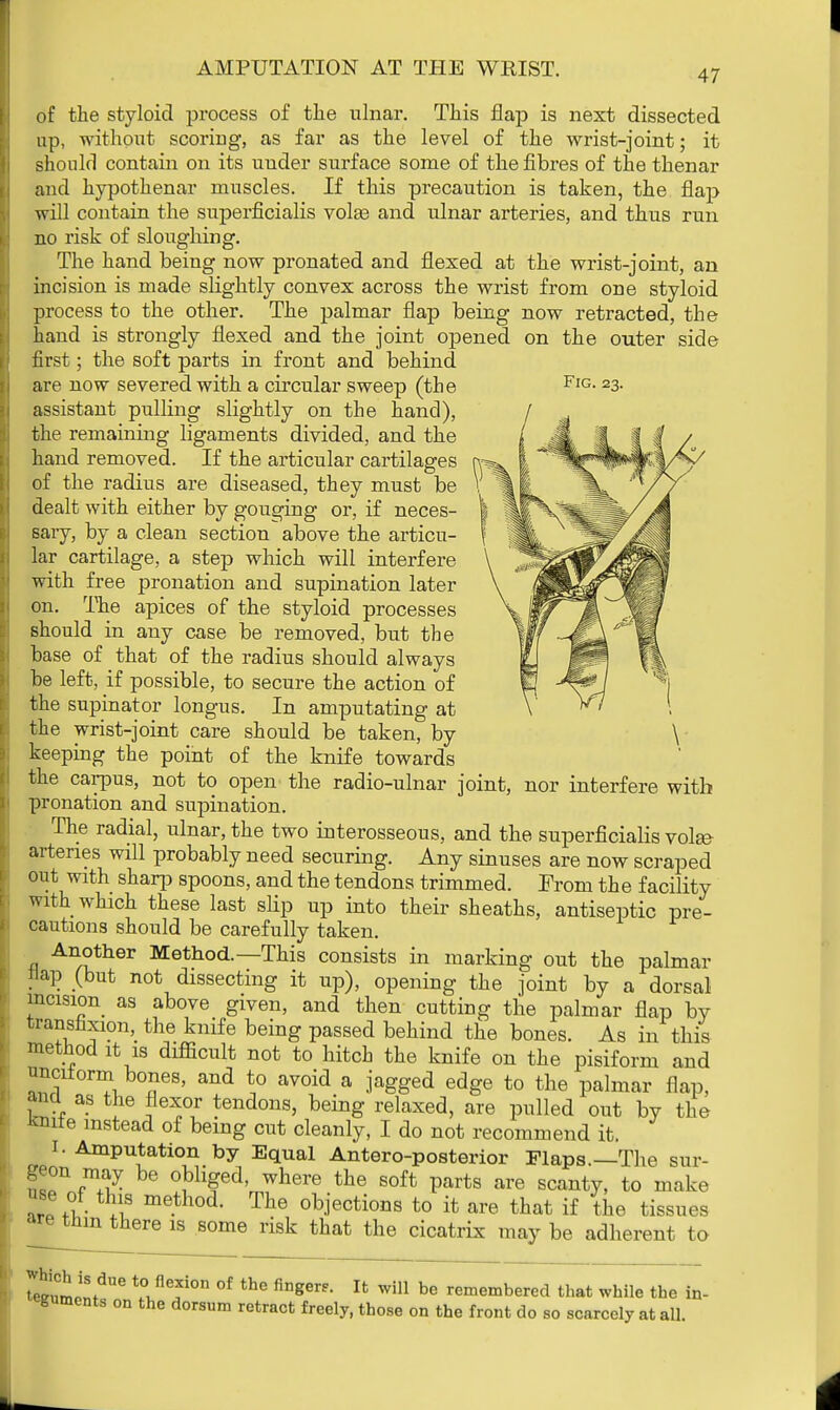 Fig. 23. of the styloid process of the ulnar. This flap is next dissected up, without scoring, as far as the level of the wrist-joint; it should contain on its under surface some of the fibres of the thenar and hypothenar muscles. If this precaution is taken, the flap will contain the superficialis volse and ulnar arteries, and thus run no risk of sloughing. The hand being now pronated and flexed at the wrist-joint, an incision is made slightly convex across the wrist from one styloid process to the other. The palmar flap being now retracted, the hand is strongly flexed and the joint opened on the outer side first; the soft parts in front and behind are now severed with a circular sweep (the assistant pulling slightly on the hand), the remaining ligaments divided, and the hand removed. If the articular cartilages r*s of the radius are diseased, they must be > dealt with either by gouging or, if neces- sary, by a clean section above the articu- lar cartilage, a step which will interfere with free pronation and supination later on. The apices of the styloid processes should in any case be removed, but the base of that of the radius should always be left, if possible, to secure the action of the supinator longus. In amputating at the wrist-joint care should be taken, by keeping the point of the knife towards the carpus, not to open the radio-ulnar joint, nor interfere with pronation and supination. The radial, ulnar, the two interosseous, and the superficialis volse- artenes will probably need securing. Any sinuses are now scraped out with sharp spoons, and the tendons trimmed. From th e facility with which these last slip up into their sheaths, antiseptic pre- cautions should be carefully taken. Another Method.—This consists in marking out the palmar flap (but not dissecting it up), opening the joint by a dorsal incision as above given, and then cutting the palmar flap by transfixion, the knife being passed behind the bones. As in this method it is difficult not to hitch the knife on the pisiform and unc1±orm bo and t ayoid a -agged edge tQ ^ and as the flexor tendons, being relaxed, are pulled out by the *mle instead of being cut cleanly, I do not recommend it. 1. Amputation by Equal Anteroposterior Flaps.—The sur- geon may be obliged, where the soft parts are scanty, to make f°v A m6-th0d- The obiectioj3s to ^ are that if the tissues are tnm there is some risk that the cicatrix may be adherent to SultdUe M^^011 °f the fingerf- Ifc wil1 be remembered that while the te- guments on the dorsum retract freely, those on the front do so scarcely at all.