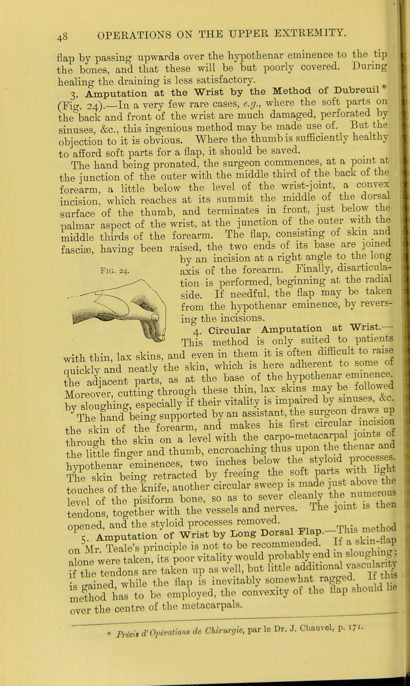 flap by passing upwards over the hypothenar eminence to the tip the bones, and that these will be but poorly covered. During healing the draining is less satisfactory. 3. Amputation at the Wrist by the Method of Dubreuil (Fig. 24). In a very few rare cases, e.g., where the soft parts on the back and front of the wrist are much damaged, perforated by sinuses, &c, this ingenious method may be made use of. But the objection to it is obvious. Where the thumb is sufficiently healthy to afford soft parts for a flap, it should be saved. The hand being pronated, the surgeon commences, at a point at the junction of the outer with the middle third of the back of the forearm, a little below the level of the wrist-joint, a convex incision, which reaches at its summit the middle of the dorsal surface of the thumb, and terminates in front, just below the palmar aspect of the wrist, at the junction of the outer with the middle thirds of the forearm. The flap, consisting of skin and fasciffi, having been raised, the two ends of its base are pined by an incision at a right angle to the long Fig. 24. axis of the forearm. Finally, disarticula- tion is performed, beginning at the radial side. If needful, the flap may be taken from the hypothenar eminence, by revers- ing the incisions. 4. Circular Amputation at Wrist.— This method is only suited to patients with thin lax skins, and even in them it is often difficult to raise ^lyNeatly the skin, which is here adherent to some of the adjacent parts, as at the base of the hypothenar eminence Moreover, cutting through these thin, lax skins may be followed fy sWhing, especially if their vitality is impaired by sinuses, &C| \he Wbeing supported by an assistant, the surgeon draws up theskiuof the forearm, and makes his first circular incision through the skin on a level with the carpometacarpaljoints of heTitte finger and thumb, encroaching ^P^^^ hvpothenar eminences, two inches below the styloid F^e^s The sMn being retracted by freeing the soft parts with light touches of the knife, another circular sweep is made just above the £dor the Pisiform bone, so as to sever cleanly the numerous tendons, together with the vessels and nerves. The joint is the| opened, and the styloid processes removed. 5. Amputation of Wrist by Long Dorsal ^P--T^^tho| Mr Tale's principle is not to be recommended. It a skin-nap f wS Sr oo, vitality would probably end in sloughing* tfS tenaonfie talL up as /ell, but little additional t rained while the flap is inevitably somewhat ragged If thffl l&B to be employed, the convexity of the flap should he over the centre of the metacarpals. * Prim d'Optratlons de Chirurgie, par le Dr. J. Chauvel, p. 171.