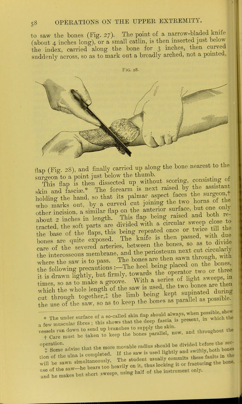 to saw the bones (Fig. 27). The point of a narrow-bladed knife (about 4 inches long), or a small catlin, is then inserted just below the index, carried along the bone for 3 inches, then curved suddenly across, so as to mark out a broadly arched, not a pointed, Fig. 28. flap (Fig. 28), and finally carried up along the bone nearest to the smro-eon to a point iust below the thumb. . ThTs flap is then dissected up . without scoring skin and fascia** The forearm is next raised by ^the ^sistant holding the hand, so that its palmar aspect faces the surgeon , who marks out, by a curved cut joining the two han^^e other incision, a similar flap on the anterior surface, but one only nbout 2 inches in length. This flap being raised and both re tion of the ulna is completed. B^ « ^ ^ ^ ,„ tbe ^XTw^S^^tt^ loci,ne it o, *e hon* True makelb,,, s„or, sweep,, nsing Ml of the i— o„.v.