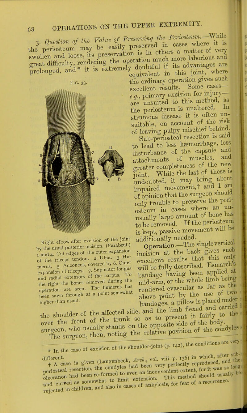 Fig. 33. Right elbow after excision of*6 joint bv the usual posterior incision. (Farabeuf.) x and 4. Cut edges of the outer expansion of the triceps tendon. 2. Ulna. 3-Hu- merus. 5. Anconeus, covered by 6. Outer Expansion of triceps. 7- Supinator longus and radial extensors of the carpus. To the right the bones removed during the operaUon are seen. The humerus has been sawn through at a point somewhat higher than usual. 68 OPERATIONS ON THE UPPER EXTREMITY. great difficulty lendermg ^P a ^ ad tages are prolonged, and it is extreme y ^ ^ ^ joint) where the ordinary operation gives such excellent results. Some cases— e q., primary excision for injury- are unsuited to this method, as the periosteum is unaltered. In strumous disease it is often un- suitable, on account of the risk of leaving pulpy mischief behind. Sub-periosteal resection is said to lead to less haemorrhage, less disturbance of the capsule and attachments of muscles, and ereater completeness of the new foint While the last of these is undoubted, it may bring about impaired movement^ and 1 am of opinion that the surgeon should only trouble to preserve the peri- osteum in cases where an un- usually large amount of bone has to be removed. If the periosteum is kept, passive movement will oe additionally needed. Operation.—The single vertical incision at the back gives such excellent results that this only will be fully described. Esmarchs bandage having been applied at mid-a?m, or the whole limb being rendered evascular as far as the above point by the use of two bandages, a pillow is placed under the shoulder of the affected side, and Z»