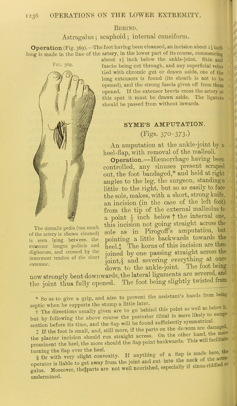 Behind. Astragalus ; scaphoid ; internal cuneiform. Operation (Fig. 369). —The foot having been cleansed, an incision about 14 inch long is made in the line of the artery, in the lower part of its course, commencing about 1A inch below the ankle-joint. Skin and fascife being cut through, and any superficial veins tied with chromic gut or drawn aside, one of the long extensors is found (its sheath is not to be opened), and the strong fascia given off from them opened. If the extensor brevis cross the artery at this spot it must be drawn aside. The ligature should be passed from without inwards. SYME'S AMPUTATION. (Figs. 370-373-) An amputation at the ankle-joint by a heel-flap, with removal of the malleoli. Operation.—Hemorrhage having been controlled, any sinuses present scraped out, the foot bandaged,* and held at right angles to the leg, the surgeon, standing a little to the right, but so as easily to face the sole, makes, with a short, strong knife, an incision (in tbe case of the left foot) from the tip of the external malleolus to a point I incb below f the internal one. this incision not going straight across the sole as in Pirogoff's amputation, but pointing a little backwards towards the heel 4 The horns of this incision are then joined by one passing straight across the ioint.§ and severing everything at once clown to the ankle-joint. The foot being now strongly bent downwards, the lateral ligaments are severed and the joint thus fully opened. The foot being slightly twisted from  M3o as to give a grip, and aio to prevent the assistant's hands from being septic when he supports the stump a little later. t The directions usually given are to go behind this point as well as below'U, but by following the above course the posterior tibial is more likely to escape section before its time, and the flap will be found sufficiently *T^«™£ t If the foot is small, and, still more, if the parts on the dorsum are dama^fl, the plantar incision should run straight across On the other^^Jj prominent the heel, the more should the flap point backwards. This will facilit turning the flap over the heel. . , tj,e 8 Or with very slight convexity. If anything of a flap » operator is liable to get away from the joint and cut into toe neck o he a- • gains. Moreover, thejparts are not well nourished, especially if sum, nddie undermined. The dorsalis pedis (too much of the artery is shown cleaned) is seen lying between the extensor longus pollicis and digitorum, and crossed by the innermost tendon of the short extensor.