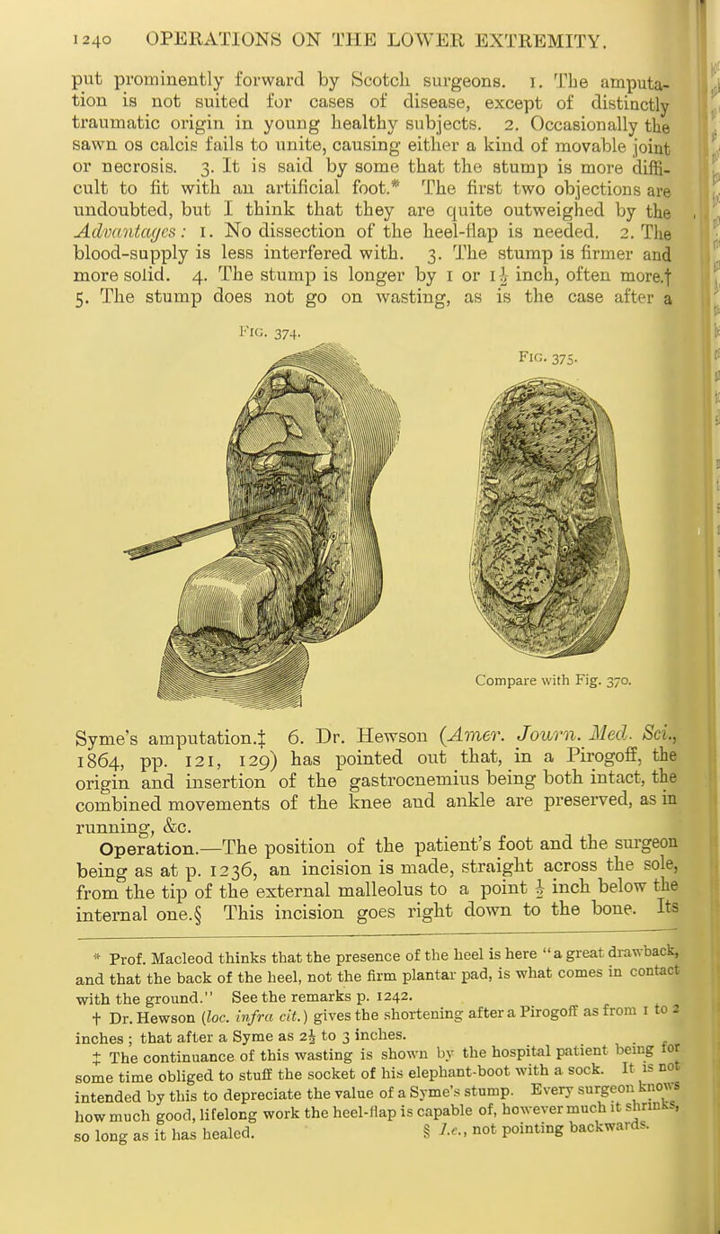 put prominently forward by Scotch surgeons, i. The amputa- tion is not suited for cases of disease, except of distinctly traumatic origin in young healthy subjects. 2. Occasionally the sawn os calcis fails to unite, causing either a kind of movable joint or necrosis. 3. It is said by some that the stump is more diffi- cult to fit with an artificial foot.* The first two objections are undoubted, but I think that they are quite outweighed by the Advantages: 1. No dissection of the heel-flap is needed. 2. The blood-supply is less interfered with. 3. The stump is firmer and more solid. 4. The stump is longer by 1 or ii inch, often more.t 5. The stump does not go on wasting, as is the case after a Fig. 374- Fig. 375- Compare with Fig. 370. Syme's amputation.} 6. Dr. Hewson (Amer. Journ. Med. ScL, 1864, pp. 121, 129) has pointed out that, in a Pirogoff, the origin and insertion of the gastrocnemius being both intact, the combined movements of the knee and ankle are preserved, as in running, &c. Operation.—The position of the patient's foot and the surgeon being as at p. 1236, an incision is made, straight across the sole, from the tip of the external malleolus to a point h inch below the internal one.§ This incision goes right down to the bone. Its * Prof. Macleod thinks that the presence of the heel is here a great drawback, and that the back of the heel, not the firm plantar pad, is what comes in contact with the ground. See the remarks p. 1242. t Dr. Hewson {loc. infra cit.) gives the shortening after a Pirogoff as from 1 to 2 inches ; that after a Syme as z\ to 3 inches. t The continuance of this wasting is shown by the hospital patient being tor some time obliged to stuff the socket of his elephant-boot with a sock. It is not intended by this to depreciate the value of a Syme's stump. Every surgeon knows how much good, lifelong work the heel-nap is capable of, however much it shnnKSj so long as it has healed. § Le., not pointing backwards.