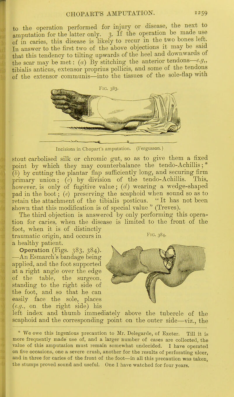 to the operation performed for injury or disease, the next to amputation for the latter only. 3. If the operation be made use of in caries, this disease is likely to recur in the two bones left. In answer to the first two of the above objections it may be said that this tendency to tilting upwards of the heel and downwards of the scar may be met: (a) By stitching the anterior tendons—e.g„ tibialis anticus, extensor proprius pollicis, and some of the tendons of the extensor communis—into the tissues of the sole-flap with Fig. 383 Incisions in Chopart's amputation. (Fergusson.) stout carbolised silk or chromic gut, so as to give them a fixed point by which they may counterbalance the tendo-Achillis; * (b) by cutting the plantar flap sufficiently long, and securing firm primary union; (c) by division of the tendo-Achillis. This, however, is only of fugitive value; (d) wearing a wedge-shaped pad in the boot; (e) preserving the scaphoid when sound so as to retain the attachment of the tibialis posticus.  It has not been shown that this modification is of special value  (Treves). The third objection is answered by only performing this opera- tion for caries, when the disease is limited to the front of the foot, when it is of distinctly traumatic origin, and occurs in FlG- 3§4- a healthy patient. Operation (Figs. 383, 384). —An Esmarch's bandage being applied, and the foot supported at a right angle over the edge of the table, the surgeon, standing to the right side of the foot, and so that he can easily face the sole, places (e.g., on the right side) his left index and thumb immediately above the tubercle of the scaphoid and the corresponding point on the outer side—viz., the * We owe this ingenious precaution to Mr. Delegarde, of Exeter. Till it is more frequently made use of, and a larger number of cases are collected, the value of this amputation must remain somewhat undecided. I have operated on five occasions, one a severe crush, another for the results of perforating ulcer, and in three for caries of the front of the foot—in all this precaution was taken, the stumps proved sound and useful. One I have watched for four years.