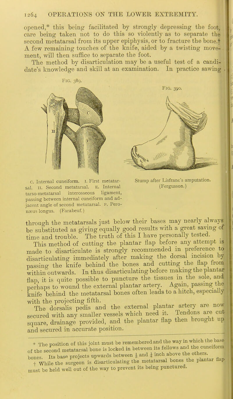 opened,* this being- facilitated by strongly depressing the foot, care being taken not to do this so violently as to separate the second metatarsal from its upper epiphysis, or to fracture the bone.t A few remaining touches of the knife, aided by a twisting move- ment, will then suffice to separate the foot. The method by disarticulation may be a useful test of a candi- date's knowledge and skill at an examination. In practice sawiug Fig. 390. C. Internal cuneiform. I. First metatar- Stump after Lisfranc's amputation, sal. 11. Second metatarsal. E. Internal (Fergusson.) tarso-metatarsal interosseous ligament, passing between internal cuneiform and ad- jacent angle of second metatarsal, v. Pero- naeus longus. (Farabeuf.) through the metatarsals just below their bases may nearly always be substituted as giving equally good results with a great saving of time and trouble. The truth of this I have personally tested. _ This method of cutting the plantar flap before any attempt is made to disarticulate is strongly recommended in preference to disarticulating immediately after making the dorsal incision by passing the knife behind the bones and cutting the flap from within outwards. In thus disarticulating before making the plantar flap it is quite possible to puncture the tissues m the sole, and perhaps to wound the external plantar artery. Again passing the tnife behind the metatarsal bones often leads to a hitch, especially with the proiecting fifth. The dorsalis pedis and the external plantar artery are now secured with any smaller vessels which need it. Tendons are cut square, drainage provided, and the plantar flap then brought up and secured in accurate position. * The position of this joint must be remembered and the way in which the base of the second metatarsal bone is locked in between its fellows and the cunetform bones Its base projects upwards between 4 and } inch above the others While the surgeon is disarticulating the metatarsal bones the plantar flap must be held well out of the way to prevent its being punctured.