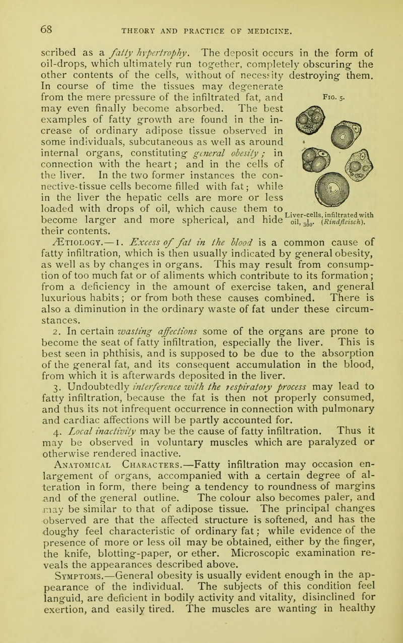 scribed as a fatty hypertrophy. The deposit occurs in the form of oil-drops, which ultimately run together, completely obscuring- the other contents of the cells, without of necessity destroying- them. In course of time the tissues may degenerate from the mere pressure of the infiltrated fat, and may even finally become absorbed. The best examples of fatty growth are found in the in- crease of ordinary adipose tissue observed in some individuals, subcutaneous as well as around internal organs, constituting general obesity; in connection with the heart; and in the cells of the liver. In the two former instances the con- nective-tissue cells become filled with fat; while in the liver the hepatic cells are more or less loaded with drops of oil, which cause them to , , ... j Liver-cells, infiltrated with become larger and more spherical, and hide oil, 3j0. (Rindfleisch). their contents. /Etiology.—I. Excess 0/ fat in the blood is a common cause of fatty infiltration, which is then usually indicated by general obesity, as well as by changes in organs. This may result from consump- tion of too much fat or of aliments which contribute to its formation ; from a deficiency in the amount of exercise taken, and general luxurious habits; or from both these causes combined. There is also a diminution in the ordinary waste of fat under these circum- stances. 2. In certain toasting affections some of the organs are prone to become the seat of fatty infiltration, especially the liver. This is best seen in phthisis, and is supposed to be due to the absorption of the general fat, and its consequent accumulation in the blood, from which it is afterwards deposited in the liver. 3. Undoubtedly interference with the respiratory process may lead to fatty infiltration, because the fat is then not properly consumed, and thus its not infrequent occurrence in connection with pulmonary and cardiac affections will be partly accounted for. 4. Local inactivity may be the cause of fatty infiltration. Thus it may be observed in voluntary muscles which are paralyzed or otherwise rendered inactive. Anatomical Characters.—Fatty infiltration may occasion en- largement of organs, accompanied with a certain degree of al- teration in form, there being a tendency to roundness of margins and of the general outline. The colour also becomes paler, and r.iay be similar to that of adipose tissue. The principal changes observed are that the affected structure is softened, and has the doughy feel characteristic of ordinary fat: while evidence of the presence of more or less oil may be obtained, either by the finger, the knife, blotting-paper, or ether. Microscopic examination re- veals the appearances described above. Symptoms.—General obesity is usually evident enough in the ap- pearance of the individual. The subjects of this condition feel languid, are deficient in bodily activity and vitality, disinclined for exertion, and easily tired. The muscles are wanting in healthy