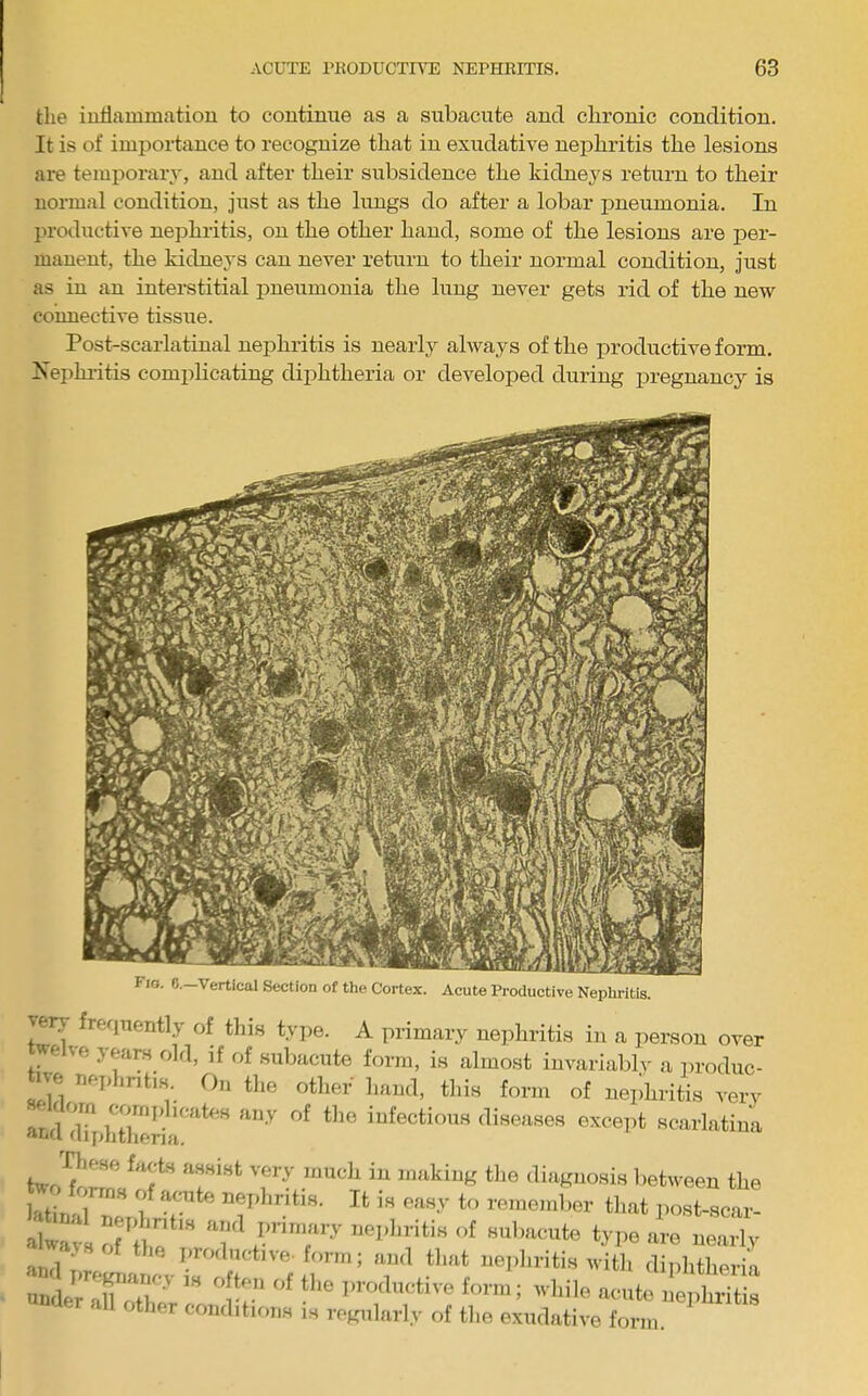 the iuhammatiou to continue as a subacute and chronic condition. It is of importance to recognize that in exudative nephritis the lesions are temporary, and after their subsidence the kidneys return to their normal condition, just as the lungs do after a lobar pneumonia. In ju-oductive nephritis, on the other hand, some of the lesions are per- manent, the kidneys can never return to their normal condition, jiist as in an interstitial pneumonia the lung never gets rid of the new connective tissue. Post-scarlatinal nephritis is nearly always of the productive form. Nephritis complicating diphtheria or developed during x>regnancy is Fio. 6.-Vertical Section of the Cortex. Acute Productive Nephritis. verj frequently of this type. A primary nephritis in a person over we te years old, if of suliacute form, is almost iuvariablv a iiroduc- tive nei,l,rit.s On tlie other' hand, this form of nejihritis very iufectious diseases exce])t scarlatina anfi ai[>htlieria. riicse J]||3 iliuguosis between the . , tonne of „™te ne„l,ritie. It i„ eney to ren.e.nber that post-1 ! •all: Tit rr ami * I’rochictive form; ami that nephritis with diphtlieria th( r conditions is regularly of the exudative form.