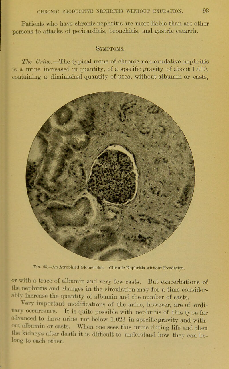 Patieuts avIio have chronic nephritis are more liable than are other persons to attacks of pericarditis, bronchitis, and gastric catairh. Symptoms. The Urine.—The typical mine of chronic non-exndative nephritis is a mine increased in quantity, of a specific gravity of about 1.010, containing a diminished quantity of urea, without albumin or casts. Fio. 25.—,\n Atrophied Glomerulus. Chronic Nephritis without Exudation, or with a trace of allnimin and very few casts. But exacerbations of the nephritis and changes in the circulation may for a time consider- ably increase the t^uantity of albumin and the number of casts. \ ery imjtoi-tant modifications of the urine, hoAvever, are of ordi- nary occurrence. It is tpiite itossible witli nejdiritis of this type far advanced to have urine not below 1.023 in specific gravity and with- out albumin t)r casts. When one sees this urine during life and then the kidneys after death it is difficult to understand how they can be- long tfj each other.