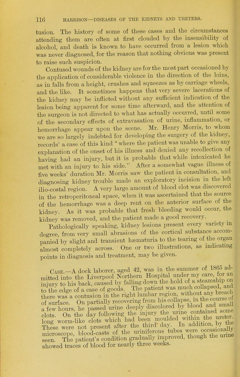 tusion. The history of some of these cases and the circumstances attending them are often at first clouded by the insensibility of alcohol, and death is known to have occurred from a lesion which was never diagnosed, for the reason that nothing obvious was present to raise such suspicion. Contused wounds of the kidney are for the most part occasioned by the application of considerable violence in the direction of the loins, as in falls from a height, crushes and squeezes as by carriage wheels, and the like. It sometimes happens that very severe lacerations of the kidney may be inflicted without any sufficient indication of the lesion being apparent for some time afterward, and the attention of the surgeon is not directed to what has actually occuired, until some of the secondary effects of extravasation of urine, inflammation, or hemorrhage appear upon the scene. Mr. Hem'y Morris, to whom we are so largely indebted for developing the surgery of the kidney, records' a case of this kind “ where the patient was unable to give any explanation of the onset of his illness and denied any recoUection of having had an injury, but it is probable that while intoxicated he met with an injury to his side.” After a somewhat vague iUness of five weeks’ duration Mr. Morris saw the patient in consultation, and diagnosing kidney ti-ouble made an exploratory incision in the left ilio-costal region. A very large amount of blood clot was discovered in the retroperitoneal space, when it was ascertained that the source of the hemorrhage was a deep rent on the anterior surface of the kidney. As it was probable that fresh bleeding would occur, the kidney was removed, and the patient made a good recovery. Pathologically speaking, kidney lesions present every variety in degree, from very small abrasions of the cortical substance accom- panied by slight and transient hsematuria to the tearing of the organ almost completely across. One or two illustrations, as indicating points in diagnosis and treatment, may be given. CASE.-Adock laborer, aged 42, was in the summer of 1865 ad- mitted into the Liverpool Northern Hospital under my caie, toi an injurv to his back, caused by falling down the hold of a ^ to the edge of a case of goods. The patient was there was a contusion in the right lumbar region oomS of of surface. On partially recovering from his a few hours, he passed urine deeply discolored by blood and smai clots. On the day following the inpiry long worm-like clots which had been These were not present after the third day. In addition, J . Soseope, UooLaste of. the unniferoue tabes seen. The patient’s condition gradually impiove , g showed traces of blood for nearly three weeks.