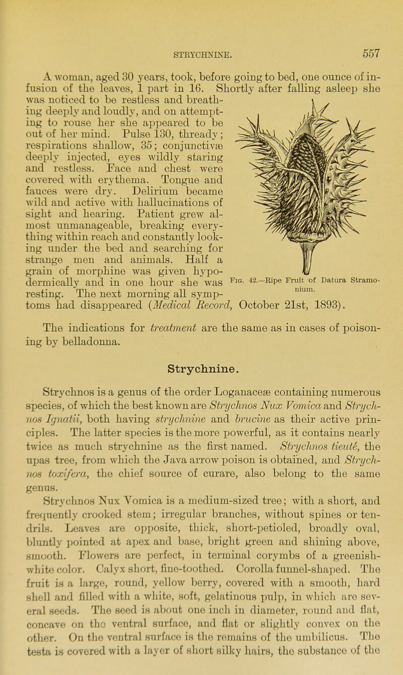 A woman, aged 30 years, took, before going to bed, one ounce of in- fusion of the leaves, 1 part in 16. Shortly after falling asleep she was noticed to be restless and breath- ing deeply and loudly, and on attemjjt- ing to rouse her she appeared to be out of her mind. Pulse 130, thready; respirations shallow, 35; conjunctivte deeply injected, ejes wildly staring and restless. Face and chest were covered with erythema. Tongue and fauces were dry. Delirium became wild and active with hallucinations of sight and hearing. Patient grew al- most unmanageable, breaking every- thing within reach and constantly look- ing under the bed and searching for strange men and animals. Half a grain of morphine was given hypo- dermically and in one hour she was ^i- 43—Ripe Fruit of Datura stramo- resting. The next morning all symp- toms had disappeared (Medical Record, October 21st, 1893). The indications for treatment are the same as in cases of poison- ing by belladonna. Strychnine. Strychnos is a genus of the order Loganaceae containing numerous species, of which the best known are Strychnos Nux Vomica and Stnjcli- no8 Ignatii, both having sti~yclinine and brucine as their active prin- ciples. The latter species is the more powerful, as it contains nearly twice as much strychnine as the first named. Strychnos tieutS, the upas tree, from which the Java arrow poison is obtained, and Strych- nos toxifera, the chief source of curare, also belong to the same genus. Strychnos Nux Vomica is a medium-sized tree; with a short, and frequently crooked stem; in-egular branches, without spines or ten- drils. Leaves are opposite, thick, short-petioled, broadly oval, bluntly pointed at apex and base, bright green and shining above, smooth. Flowers are perfect, in terminal corymbs of a greenish- white color. Calyx short, fine-toothed. Corolla funnel-shaped. The fruit is a large, round, yellow l)erry, covered with a smooth, hard shell and filled with a white, soft, gelatinous pulp, in which are sev- eral seeds. The seed is about one inch in diameter, round and flat, concave on tho ventral surface, and flat or slightly convex on the other. On the ventral surface is the remains of the umbilicus. The testa is covered with a layer of short silky hairs, the substance of the
