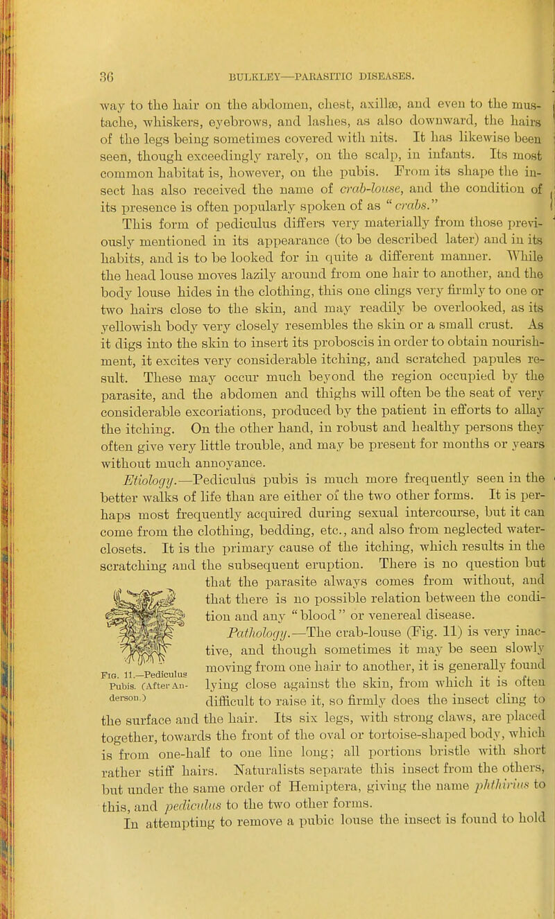 way to tlie hair on the abdomen, chest, axilla), and even to the mus- tache, whiskers, eyebrows, and lashes, as also downward, the hairs of the legs being sometimes covered with nits. It has likewise been seen, though exceedingly rarely, on the scalp, in infants. Its most common habitat is, however, on the pubis. From its silape the in- sect lias also received the name of crab-louse, and the condition of its presence is often popularly spoken of as “crabs.” This form of pediculus differs very materially from those previ- ously mentioned in its appearance (to be described later) and in its habits, and is to be looked for in quite a different manner. While the head louse moves lazily around from one hair to another, and the body louse hides in the clothing, this one clings very firmly to one or two hairs close to the skin, and may readily be overlooked, as its yellowish body very closely resembles the skin or a small crust. As it digs into the skin to insert its proboscis in order to obtain nourish- ment, it excites very considerable itching, and scratched papules re- sult. These may occur much beyond the region occupied by the parasite, and the abdomen and thighs will often be the seat of very considerable excoriations, produced by the patient in efforts to allay the itching. On the other hand, in robust and healthy persons they often give very little trouble, and may be present for months or years without much annoyance. Etiology.—Pediculus pubis is much more frequently seen in the better walks of life than are either of the two other forms. It is per- haps most frequently acquired during sexual intercourse, but it can come from the clothing, bedding, etc., and also from neglected water- closets. It is the primary cause of the itching, which results in the scratching and the subsequent eruption. There is no question but that the parasite always comes from without, and that there is no possible relation between the condi- tion and any “blood” or venereal disease. Pathology.—The crab-louse (Fig. 11) is very inac- tive, and though sometimes it may be seen slowly moving from one hair to another, it is generally found lying close against the skin, from which it is often difficult to raise it, so firmly does the insect cling to the surface and the hair. Its six legs, with strong claws, are placed together, towards the front of the oval or tortoise-shaped body, which is from one-half to one line long; all portions bristle with short rather stiff hairs. Naturalists separate this insect from the others, but under the same order of Iiemiptera, giving the name phthinus to this, and pediculus to the two other forms. In attempting to remove a pubic louse the insect is found to hold Fio. 11.—Pediculus Pubis. CAfter An- derson.)