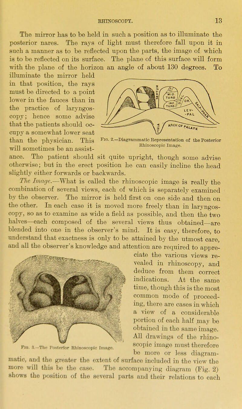 Fir. 2.—Diagrammatic Representation of the Posterior Rhinoscopic Image. The mirror has to be held in such a position as to illuminate the posterior nares. The rays of light must therefore fall upon it in such a manner as to be reflected upon the parts, the image of which is to be reflected on its surface. The plane of this surface will form with the plane of the horizon an angle of about 130 degrees. To illuminate the mirror held in that position, the rays must be directed to a point lower in the fauces than in the practice of laryngos- copy; hence some advise that the patients should oc- cupy a somewhat lower seat than the physician. This will sometimes be an assist- ance. The patient should sit quite upright, though some advise otherwise; but in the erect position he can easily incline the head slightly either forwards or backwards. The Image.—What is called the rhinoscopic image is really the combination of several views, each of which is separately examined by the observer. The mirror is held first on one side and then on the other. In each case it is moved more freely than in laryngos- copy, so as to examine as wide a field as possible, and then the two halves—each composed of the several views thus obtained—are blended into one in the observer's mind. It is easy, therefore, to understand that exactness is only to be attained by the utmost care, and all the observer's knowledge and attention are required to appre- ciate the various views re- vealed in rhinoscopy, and deduce from them correct indications. At the same time, though this is the most common mode of proceed- ing, there are cases in which a view of a considerable portion of each half may be obtained in the same image. All drawings of the rhino- scopic image must therefore be more or less diagram- matic, and the greater the extent of surface included in the view the more will this be the case. The accompanying diagram (Fig. 2) shows the position of the several parts and their relations to each Fro. 3.—The Posterior Rhinoscopic Image.