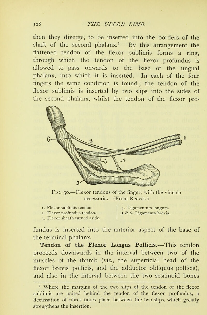 then they diverge, to be inserted into the borders of the shaft of the second phalanx.^ By this arrangement the flattened tendon of the flexor subhmis forms a ring, through which the tendon of the flexor profundus is allowed to pass onwards to the base of the ungual phalanx, into which it is inserted. In each of the four fingers the same condition is found; the tendon of the flexor sublimis is inserted by two slips into the sides of the second phalanx, whilst the tendon of the flexor pro- fundus is inserted into the anterior aspect of the base of the terminal phalanx. Tendon of the Flexor Longus PoUicis.—This tendon proceeds downwards in the interval between two of the muscles of the thumb (viz., the superficial head of the flexor brevis pollicis, and the adductor obliquus pollicis), and also in the interval between the two sesamoid bones ^ Where the margins of the two slips of the tendon of the flexor sublimis are united behind the tendon of the flexor profundus, a decussation of fibres takes place between the two slips, which greatly strengthens the insertion. 1 Fig. 30.—Flexor tendons of the finger, with the vincula accessoria. (From Reeves.) 1. Flexor sublimis tendon. 4. Ligamentum longum. 2. Flexor profundus tendon. 5 & 6. Ligamenta brevia. 3. Flexor sheath turned aside.