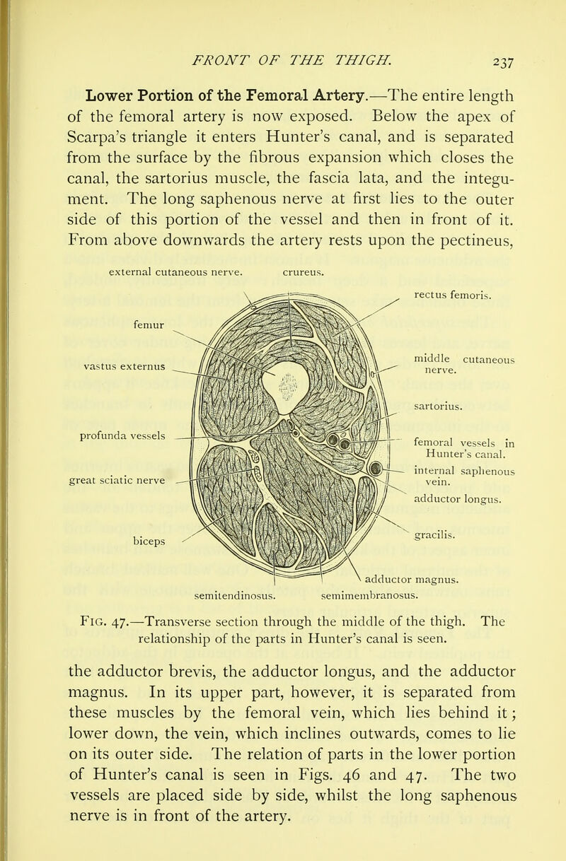 Lower Portion of the Femoral Artery.—The entire length of the femoral artery is now exposed. Below the apex of Scarpa's triangle it enters Hunter's canal, and is separated from the surface by the fibrous expansion which closes the canal, the sartorius muscle, the fascia lata, and the integu- ment. The long saphenous nerve at first lies to the outer side of this portion of the vessel and then in front of it. From above downwards the artery rests upon the pectineus, external cutaneous nerve. crureus. vastus profunda great sciatic semitendinosus. semimembranosus. Fig. 47.—Transverse section through the middle of the thigh. The relationship of the parts in Hunter's canal is seen. the adductor brevis, the adductor longus, and the adductor magnus. In its upper part, however, it is separated from these muscles by the femoral vein, which lies behind it; lower down, the vein, which inclines outwards, comes to lie on its outer side. The relation of parts in the lower portion of Hunter's canal is seen in Figs. 46 and 47. The two vessels are placed side by side, whilst the long saphenous nerve is in front of the artery.