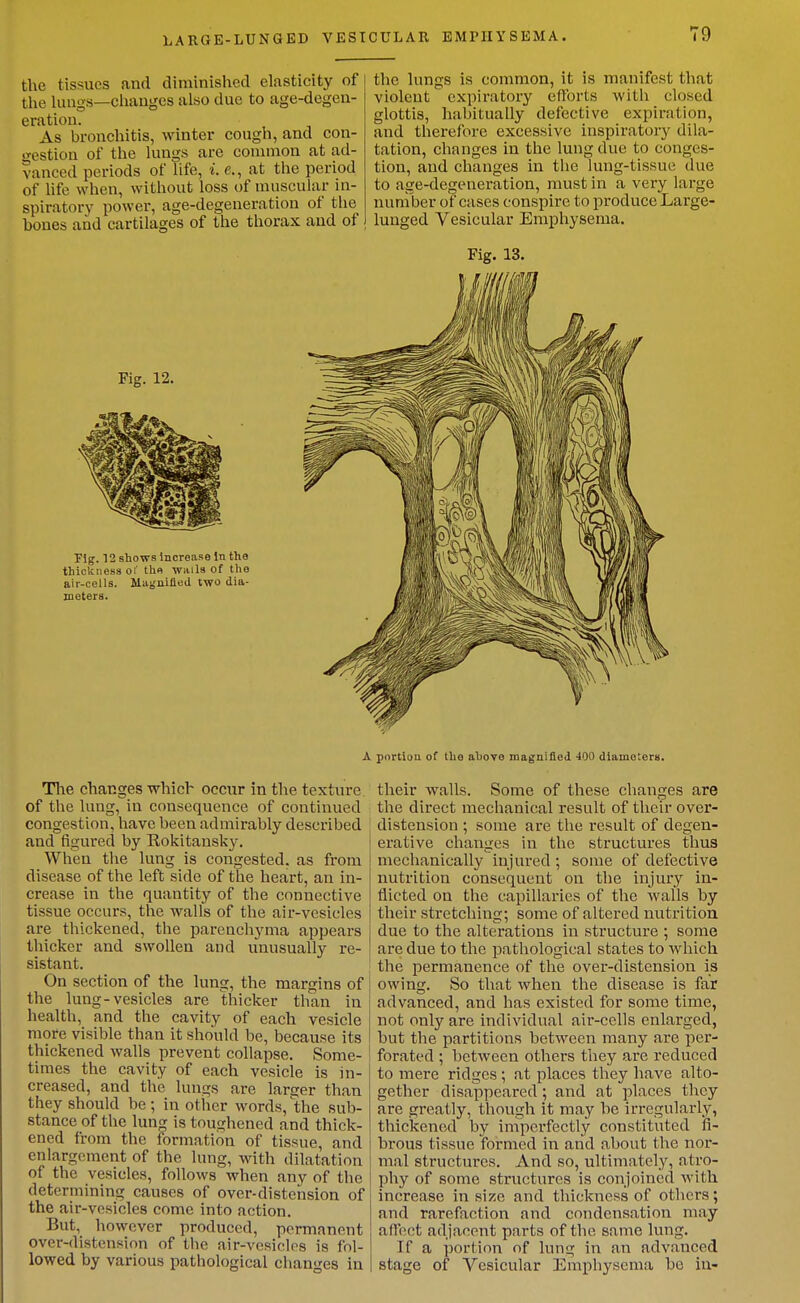 the tissues and diminished elasticity of the hmgs—changes also due to age-degen- eration. As bronchitis, winter cough, and con- «restion of the lungs are common at ad- vanced periods of life, i. e., at the period of Ufe when, without loss of muscular in- spiratory power, age-degeneration of tlie bones and cartilages of the thorax and of the lungs is common, it is manifest that violent expiratory efforts with closed glottis, habitually defective expiration, and therefore excessive inspiratory dila- tation, changes in the lung due to conges- tion, and changes in the lung-tissue due to age-degeneration, must in a very large num ber of cases conspire to produce Large- lunged Vesicular Emphysema. Fig. 13. Fig. 12. Fig. 12 shows Increase in the thickness oi the wMla of the air-cells, llagnifled two dia- meters. A portiou of the above magnified 400 diameters. Tlie changes which occur in the texture of the lung, in consequence of continued congestion, have been admirably described and figured by Rokitausky. When the lung is congested, as from disease of the left side of the heart, an in- crease in the quantity of the connective tissue occurs, the walls of the air-vesicles are thickened, the parenchyma appears thicker and swollen and unusually re- sistant. On section of the lung, the margins of the lung-vesicles are thicker than in health, and the cavity of each vesicle more visible than it should be, because its thickened walls prevent collapse. Some- times the cavity of each vesicle is in- creased, and the lungs are larger than they should be; in other words, the sub- stance of the lung is toughened and thick- ened from the formation of tissue, and enlargement of the lung, with dilatation of the vesicles, follows when any of tiie determining causes of over-distehsion of the air-vesicles come into action. But, however produced, permanent over-distension of tlie air-vcsiclos is fol- lowed by various pathological changes in their walls. Some of these changes are the direct mechanical result of their over- distension ; some are the result of degen- erative changes in the structures thus mechanically injured ; some of defective nutrition consequent on the injury in- flicted on the capillaries of the walls by their stretching; some of altered nutrition due to the alterations in structure ; some are due to the pathological states to which I the permanence of the over-distension is owing. So that when the disease is far advanced, and has existed for some time, not only are individual air-cells enlarged, but the partitions between many are i^er- forated ; between others they are reduced to mere ridges ; at places they have alto- gether disappeared ; and at places tlicy are greatly, though it may be irregularly, thickened by imperfectly constituted fi- brous tissue formed in and about the nor- mal structures. And so, ultimately, atro- phy of some structures is conjoined with increase in size and thickness of others; and rarefaction and condensation may aifpct adjacent parts of the same lung. If a portion of lung in an advanced stage of Vesicular Emphysema be in-