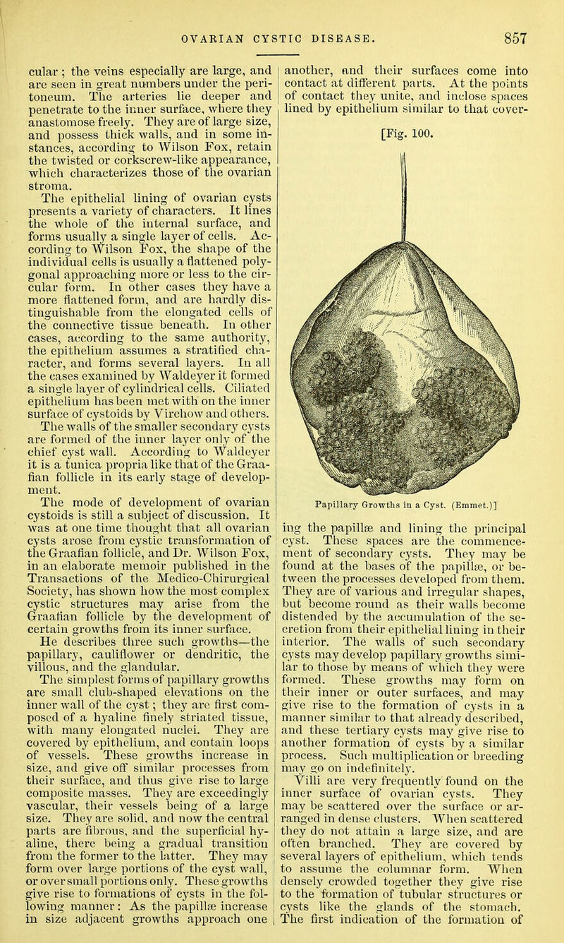 cular ; the veins especially are large, and are seen in great numbers under the peri- toneum. The arteries lie deeper and penetrate to the inner surface, where they anastomose freely. They are of large size, and possess thick walls, and in some in- stances, according to Wilson Fox, retain the twisted or corkscrew-like appearance, which characterizes those of the ovarian stroma. The epithelial lining of ovarian cysts presents a variety of characters. It lines the whole of the internal surface, and forms usually a single layer of cells. Ac- cording to Wilson Fox, the shape of the individual cells is usually a flattened poly- gonal approaching more or less to the cir- cular form. In other cases they have a more flattened form, and are hardly dis- tinguishable from the elongated cells of the connective tissue beneath. In other cases, according to the same authority, the epithelium assumes a stratified cha- racter, and forms several layers. In all the cases examined by Waldeyer it formed a single layer of cylindrical cells. Ciliated epithelium has been met with on the inner surface of cystoids by Virchow and others. The walls of the smaller secondary cysts are formed of the inner layer only of the chief cyst wall. According to Waldeyer it is a tunica propria like that of the Graa- fian follicle in its early stage of develop- ment. The mode of development of ovarian cystoids is still a subject of discussion. It was at one time thought that all ovarian cysts arose from cystic transformation of the Graafian follicle, and Dr. Wilson Fox, in an elaborate memoir published in the Transactions of the Medico-Chirurgical Society, lias shown how the most complex cystic structures may arise from the ! Graafian follicle by the development of certain growths from its inner surface. He describes three such growths—the papillary, cauliflower or dendritic, the villous, and the glandular. The simplest forms of papillary growths are small club-shaped elevations on the inner wall of the cyst; they are first com- posed of a hyaline finely striated tissue, with many elongated nuclei. They are covered by epithelium, and contain loops of vessels. These growths increase in size, and give off similar processes from their surface, and thus give rise to large composite masses. They are exceedingly vascular, their vessels being of a large size. They are solid, and now the central parts are fibrous, and the superficial hy- aline, there being a gradual transition from the former to the latter. They may J form over large portions of the cyst wall, | or over small portions only. These growths give rise to formations of cysts in the fol- lowing manner: As the papillai increase in size adjacent growths approach one j another, and their surfaces come into contact at different parts. At the points of contact they unite, and inclose spaces lined by epithelium similar to that cover- [Fig. 100. Papillary Growths in a Cyst. (Emmet.)] ing the papilla? and lining the principal cyst. These spaces are the commence- ment of secondary cysts. They may be found at the bases of the papilla?, or be- tween the processes developed from them. They are of various and irregular shapes, but become round as their walls become distended by the accumulation of the se- cretion from their epithelial lining in their interior. The walls of such secondary cysts may develop papillary growths simi- lar to those by means of which they were formed. These growths may form on their inner or outer surfaces, and may give rise to the formation of cysts in a manner similar to that already described, and these tertiary cysts may give rise to another formation of cysts by a similar process. Such multiplication or breeding may go on indefinitely. Villi are very frequently found on the inner surface of ovarian cysts. They may be scattered over the surface or ar- ranged in dense clusters. When scattered they do not attain a large size, and are often branched. They are covered by several layers of epithelium, which tends to assume the columnar form. When densely crowded together they give rise to the formation of tubular structures or cysts like the glands of the stomach. The first indication of the formation of