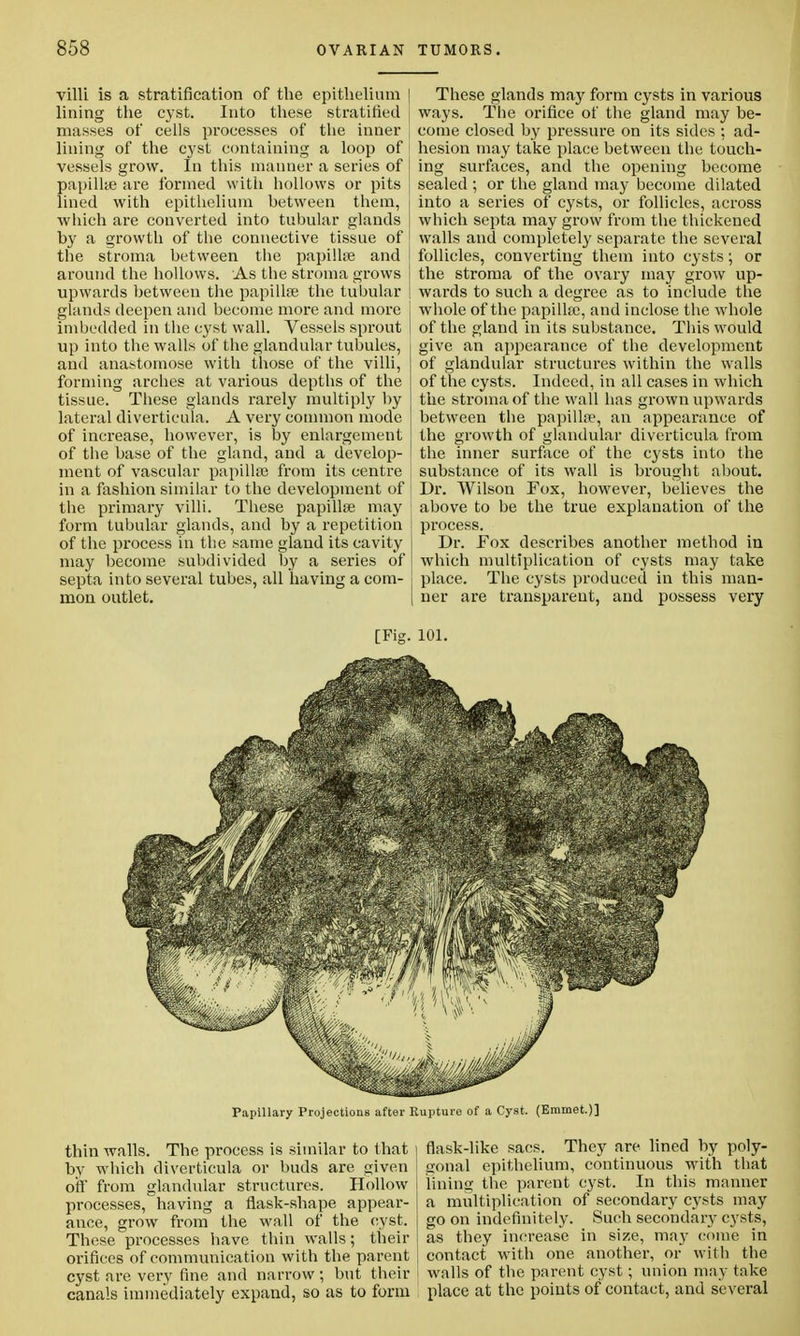 villi is a stratification of the epithelium ] lining the cyst. Into these stratified masses of cells processes of the inner lining of the cyst containing a loop of vessels grow. In this manner a series of papillae are formed with hollows or pits lined with epithelium between them, i which are converted into tubular glands by a growth of the connective tissue of j the stroma between the papillae and j around the hollows. As the stroma grows upwards between the papillae the tubular I glands deepen and become more and more j imbedded in the cyst wall. Vessels sprout up into the walls of the glandular tubules, and anastomose with those of the villi, forming arches at various depths of the tissue. These glands rarely multiply by lateral diverticula. A very common mode of increase, however, is by enlargement of the base of the gland, and a develop- ment of vascular papillae from its centre in a fashion similar to the development of the primary villi. These papillae may form tubular glands, and by a repetition of the process in the same gland its cavity may become subdivided by a series of septa into several tubes, all having a com- mon outlet. [Fig. These glands may form cysts in various ways. The orifice of the gland may be- come closed by pressure on its sides ; ad- hesion may take place between the touch- ing surfaces, and the opening become sealed ; or the gland may become dilated into a series of cysts, or follicles, across which septa may grow from the thickened walls and completely separate the several follicles, converting them into cysts; or the stroma of the ovary may grow up- wards to such a degree as to include the whole of the papillae, and inclose the whole of the gland in its substance. This would give an appearance of the development of glandular structures within the walls of the cysts. Indeed, in all cases in which the stroma of the wall has grown upwards between the papillae, an appearance of the growth of glandular diverticula from the inner surface of the cysts into the substance of its wall is brought about. Dr. Wilson Fox, however, believes the above to be the true explanation of the process. Dr. Fox describes another method in which multiplication of cysts may take place. The cysts produced in this man- ner are transparent, and possess very 101. Papillary Projections after Rupture of a Cyst. (Emmet.)] thin walls. The process is similar to that by which diverticula or buds are given off from glandular structures. Hollow processes,having a flask-shape appear- ance, grow from the wall of the cyst. These processes have thin walls; their orifices of communication with the parent cyst are very fine and narrow; but their canals immediately expand, so as to form flask-like sacs. They are lined by poly- gonal epithelium, continuous with that lining the parent cyst. In this manner a multiplication of secondary cysts may go on indefinitely. Such secondary cysts, as they increase in size, may come in contact with one another, or with the walls of the parent cyst; union may take place at the points of contact, and several