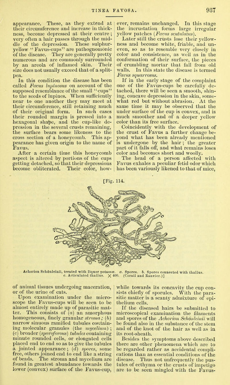 appearance. These, as they extend at their circumference and increase in thick- ness, become depressed at their centre ; very often a hair passes through the mid- dle of the depression. These sulphur- yellow  Favus-cups are pathognomonic of the disease. They are generally pretty numerous and are commonly surrounded by an areola of inflamed skin. Their size does not usually exceed that of a split- pea. In this condition the disease has been called Favus lupinosus on account of the supposed resemblance of the small cups to the seeds of lupines. When sufficiently near to one another they may meet at their circumference, still retaining much of their original form. In such cases their rounded margin is pressed into a hexagonal shape, and the cup-like de- pression in the several crusts remaining, the surface bears some likeness to the cross section of a honeycomb. This ap- pearance has given origin to the name of Favus. After a certain time this honeycomb aspect is altered by portions of the cups getting detached, so that their depressions become obliterated. Their color, how- ever, remains unchanged. In this stage the incrustation forms large irregular yellow patches (Favus scutulatus). Later still the crusts lose their yellow- ness and become white, friable, and un- even, so as to resemble very closely in color and consistence, as well as in the conformation of their surface, the pieces of crumbling mortar that fall from old walls. In this state the disease is termed Favus squarrosus. If in the early stage of the complaint one of the Favus-cups be carefully de- tached, there will be seen a smooth, shin- ing, concave depression in the skin, some- what red but without abrasion. At the same time it may be observed that the under surface of the cup is convex, and is much smoother and of a deeper 3rellow color than its free surface. Coincidently with the development of the crust of Favus a further change be- yond what has been already mentioned is undergone by the hair ; the greater part of it falls off, and what remains loses color and becomes short and woolly. The head of a person affected with Favus exhales a peculiar fetid odor which has been variously likened to that of mice, [Fig. 114. Achorion Schonleinii, treated with liquor potassse. a. Spores, b. Spores connected with thallus. e. Articulated thallus. X (Cornil and Ranvier.)] of animal tissues undergoing maceration, or of the urine of cats. Upon examination under the micro- scope the Favus-cups will be seen to be almost entirely made up of parasitic mat- ter. This consists of (a) an amorphous homogeneous, finely granular stroma; (b) narrow sinuous ramified tubules contain- ing molecular granules (the mycelium) ; (c) broader (sporoforous) tubules containing minute rounded cells, or elongated cells placed end to end so as to give the tubules a jointed appearance ; (d) spores, some free, others joined end to end like a string of beads. The stroma and mycelium are found in greatest abundance towards the lower (convex) surface of the Favus-cup, while towards its concavity the cup con- sists chiefly of sporules. With the para- sitic matter is a scanty admixture of epi- thelium cells. If the diseased hairs be submitted to microscopical examination the filaments and spores of the Achorion Schonleinii will be found also in the substance of the stem and of the knot of the hair as well as in its root-sheath. Besides the symptoms above described there are other phenomena which are to be regarded rather as accidental compli- cations than as essential conditions of the disease. Thus not infrequently the pus- tules of ecthyma or the crusts of impetigo are to be seen mingled with the Favus-