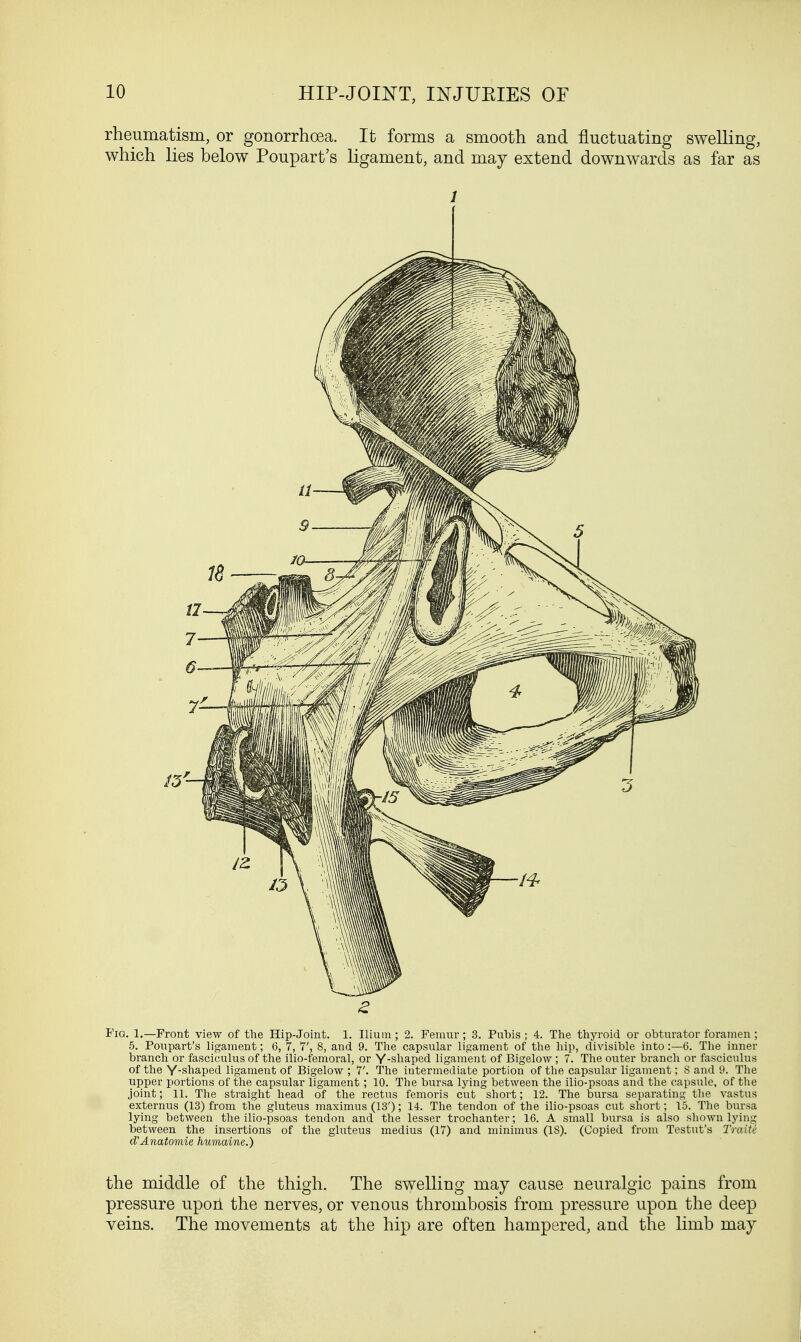 rheumatism, or gonorrhoea. It forms a smooth and fluctuating swelling, which lies below Poupart's ligament, and may extend downwards as far as J Fig. 1.—Front view of the Hip-Joint. 1. Ilium; 2. Femur; 3. Pubis ; 4. The thyroid or obturator foramen ; 5. Poupart's ligament; 6, 7, 7', 8, and 9. The capsular ligament of the hip, divisible into:—6. The inner branch or fasciculus of the ilio-femoral, or Y-shaped ligament of Bigelow ; 7. The outer branch or fasciculus of the Y-shaped ligament of Bigelow ; 7'. The intermediate portion of the capsular ligament; 8 and 9. The upper portions of the capsular ligament; 10. The bursa lying between the ilio-psoas and the capsule, of the joint; 11. The straight head of the rectus femoris cut short; 12. The bursa separating the vastus externus (13) from the gluteus maximus (13'); 14. The tendon of the ilio-psoas cut short; 15. The bursa lying between the ilio-psoas tendon and the lesser trochanter; 16. A small bursa is also shown lying between the insertions of the gluteus medius (17) and minimus (18). (Copied from Testut's Traite d'Anatomie humaine.) the middle of the thigh. The swelling may cause neuralgic pains from pressure upon the nerves, or venous thrombosis from pressure upon the deep veins. The movements at the hip are often hampered, and the limb may