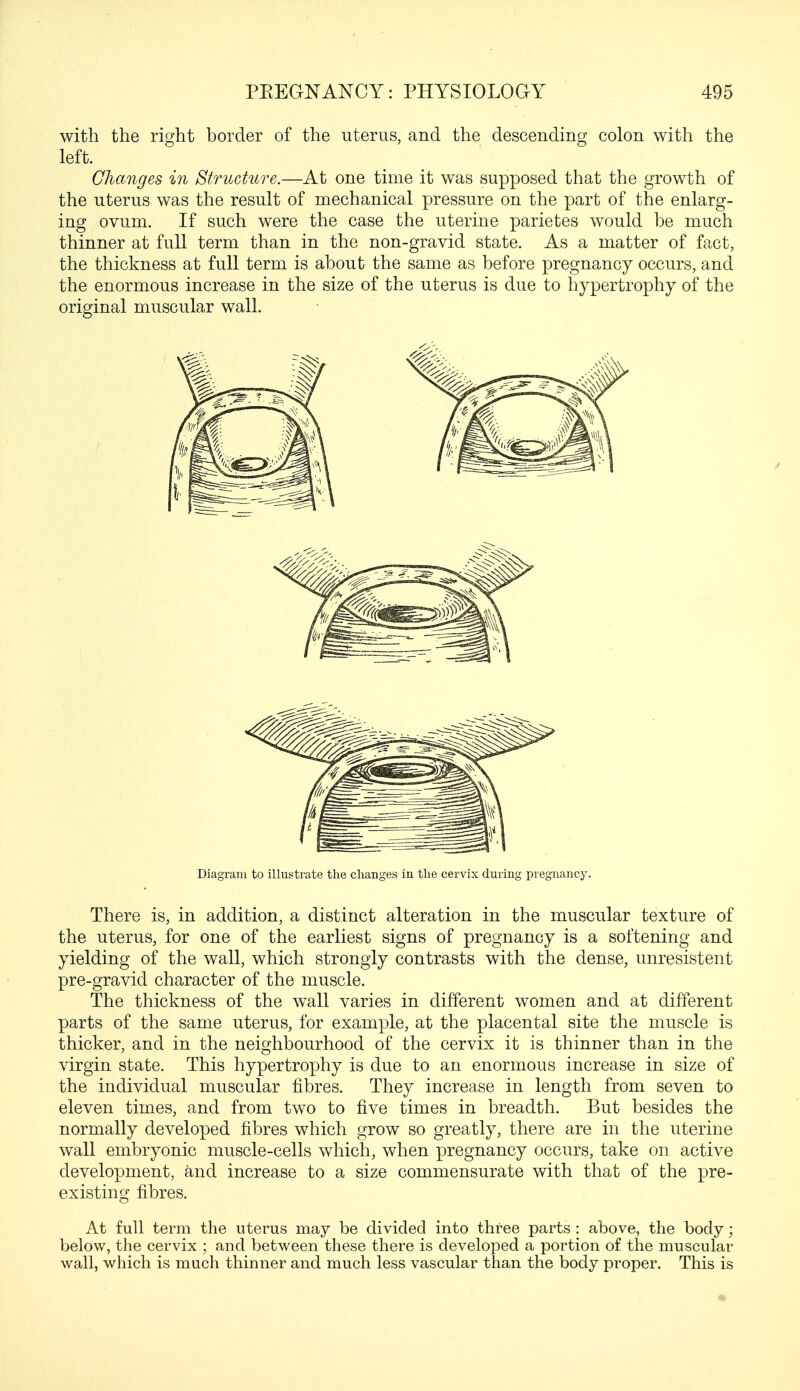 with the right border of the uterus, and the descending colon with the left. Changes in Structure.—At one time it was supposed that the growth of the uterus was the result of mechanical pressure on the part of the enlarg- ing ovum. If such were the case the uterine parietes would be much thinner at full term than in the non-gravid state. As a matter of fact, the thickness at full term is about the same as before pregnancy occurs, and the enormous increase in the size of the uterus is due to hypertrophy of the original muscular wall. Diagram to illustrate the changes in the cervix during pregnancy. There is, in addition, a distinct alteration in the muscular texture of the uterus, for one of the earliest signs of pregnancy is a softening and yielding of the wall, which strongly contrasts with the dense, unresistent pre-gravid character of the muscle. The thickness of the wall varies in different women and at different parts of the same uterus, for example, at the placental site the muscle is thicker, and in the neighbourhood of the cervix it is thinner than in the virgin state. This hypertrophy is due to an enormous increase in size of the individual muscular fibres. They increase in length from seven to eleven times, and from two to five times in breadth. But besides the normally developed fibres which grow so greatly, there are in the uterine wall embryonic muscle-cells which, when pregnancy occurs, take on active development, and increase to a size commensurate with that of the pre- existing fibres. At full term the uterus may be divided into three parts : above, the body; below, the cervix ; and between these there is developed a portion of the muscular wall, which is much thinner and much less vascular than the body proper. This is