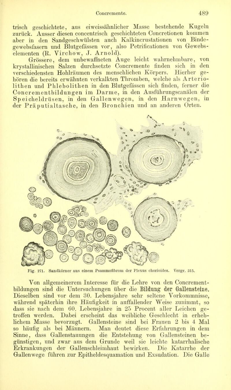 trisch geschichtete, aus eiweissähnlicher Masse bestehende Kugeln zurück. Ausser diesen concentrisch geschichteten Concretionen kommen aber in den Sandgeschwülsten auch Kalkincrustationen von Binde- gewebsfasern und Blutgefässen vor, also Petrificationen von Gewebs- elementen (K. Virchow, J. Arnold). Grössere, dem unbewaffneten Auge leicht wahrnehmbare, von krystallinischen Salzen durchsetzte Concremente finden sich in den verschiedensten Hohlräumen des menschlichen Körpers. Hierher ge- hören die bereits erwähnten verkalkten Thromben, welche als Arterio- lithen und Phlebolithen in den Blutgefässen sich finden, ferner die Concrementbildungen im Darme, in den Ausführungscanälen der Speicheldrüsen, in den Gallenwegen, in den Harnwegen, in der Präputialtasche, in den Bronchien und an anderen Orten. Fig. 271. Sandkörner aus einem Psammofibrom der Plexus chorioides. Vergr. 315. Von allgemeinerem Interesse für die Lehre von den Concrement- bildungen sind die Untersuchungen über die Bildung der Gallensteine. Dieselben sind vor dem 30. Lebensjahre sehr seltene Vorkommnisse, während späterhin ihre Häufigkeit in auffallender Weise zunimmt, so dass sie nach dem 60. Lebensjahre in 25 Procent aller Leichen ge- troffen werden. Dabei erscheint das weibliche Geschlecht in erheb- lichem Masse bevorzugt. Gallensteine sind bei Frauen 2 bis 4 Mal so häufig als bei Männern. Man deutet diese Erfahrungen in dem Sinne, dass Gallenstauungen die Entstehung von Gallensteinen be- günstigen, und zwar aus dem Grunde weil sie leichte katarrhalische Erkrankungen der Gallenschleimhaut bewirken. Die Katarrhe der Gallenwege führen zur Epitheldesquamation und Exsudation. Die Galle