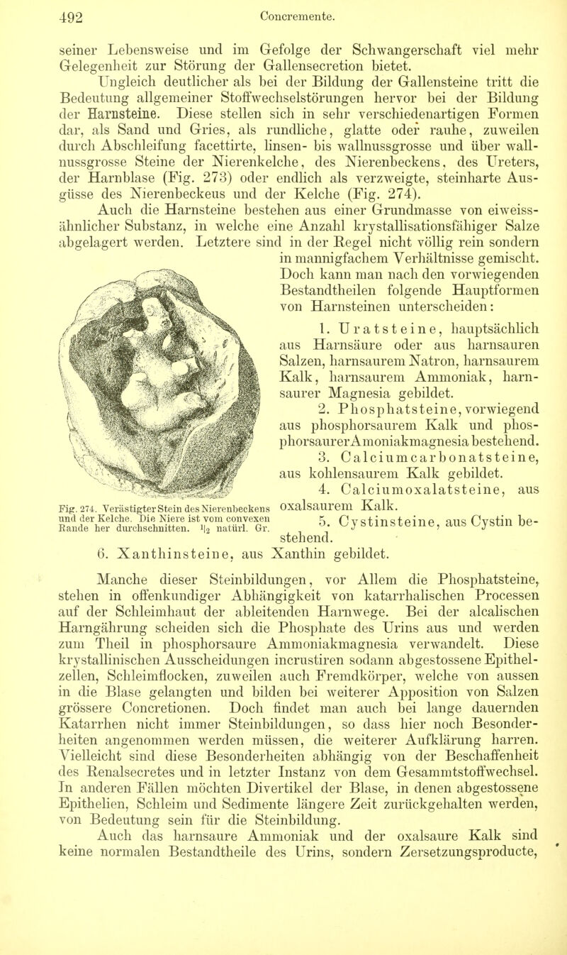 seiner Lebensweise und im Gefolge der Schwangerschaft viel mehr Gelegenheit zur Störung der Gallensecretion bietet. Ungleich deutlicher als bei der Bildung der Gallensteine tritt die Bedeutung allgemeiner Stoffwechselstörungen hervor bei der Bildung der Harnsteine. Diese stellen sich in sehr verschiedenartigen Formen dar, als Sand und Gries, als rundliche, glatte oder rauhe, zuweilen durch Abschleifung facettirte, linsen- bis wallnussgrosse und über wall- nussgrosse Steine der Nierenkelche, des Nierenbeckens, des Ureters, der Harnblase (Fig. 273) oder endlich als verzweigte, steinharte Aus- güsse des Nierenbeckeus und der Kelche (Fig. 274). Auch die Harnsteine bestehen aus einer Grundmasse von eiweiss- ähnlieher Substanz, in welche eine Anzahl krystallisationsfähiger Salze abgelagert werden. Letztere sind in der Regel nicht völlig rein sondern in mannigfachem Verhältnisse gemischt. Doch kann man nach den vorwiegenden Bestandtheilen folgende Hauptformen von Harnsteinen unterscheiden: 1. U ratsteine, hauptsächlich aus Harnsäure oder aus harnsauren Salzen, harnsaurem Natron, harnsaurem Kalk, harnsaurem Ammoniak, harn- saurer Magnesia gebildet. 2. Phosphatsteine, vorwiegend aus phosphorsaurem Kalk und phos- phorsaurerAmoniakmagnesia bestehend. 3. Calciumcarbonatsteine, aus kohlensaurem Kalk gebildet. 4. Calciumoxalatsteine, aus Fig. 274. Verästigter Stein des Nierenbeckens Oxalsaurem Kalk. ^alKfrreSSLis^^rS^G1■1 , 5; Cystinsteine, aus Cystin be- stehend. 6. Xanthinsteine, aus Xanthin gebildet. Manche dieser Steinbildungen, vor Allem die Phosphatsteine, stehen in offenkundiger Abhängigkeit von katarrhalischen Processen auf der Schleimhaut der ableitenden Harnwege. Bei der alcalischen Harngährung scheiden sich die Phosphate des Urins aus und werden zum Theil in phosphorsaure Ammoniakmagnesia verwandelt. Diese krystallinischen Ausscheidungen incrustiren sodann abgestossene Epithel- zellen, Schleimflocken, zuweilen auch Fremdkörper, welche von aussen in die Blase gelangten und bilden bei weiterer Apposition von Salzen grössere Concretionen. Doch findet man auch bei lange dauernden Katarrhen nicht immer Steinbildungen, so class hier noch Besonder- heiten angenommen werden müssen, die weiterer Aufklärung harren. Vielleicht sind diese Besonderheiten abhängig von der Beschaffenheit des Benalsecretes und in letzter Instanz von dem Gesammtstoffwechsel. In anderen Fällen möchten Divertikel der Blase, in denen abgestossene Epithelien, Schleim und Sedimente längere Zeit zurückgehalten werden, von Bedeutung sein für die Steinbildung. Auch das harnsaure Ammoniak und der Oxalsäure Kalk sind keine normalen Bestandtheile des Urins, sondern Zersetzungsproducte,