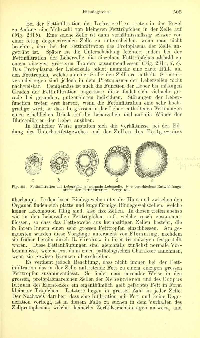 Bei der Fettinfiltration der Leberzellen treten in der Regel zu Anfang eine Mehrzahl von kleineren Fetttröpfchen in der Zelle auf (Fig. 2816). Eine solche Zelle ist dann verhältnissmässig schwer von einer fettig degenerirenden Zelle zu unterscheiden, wenn man nicht beachtet, dass bei der Fettinfiltration das Protoplasma der Zelle un- getrübt ist. Später ist die Unterscheidung leichter, indem bei der Fettinfiltration der Leberzelle die einzelnen Fetttröpfchen alsbald zu einem einzigen grösseren Tropfen zusammenfliessen (Fig. 281c, e). Das Protoplasma der Leberzelle bildet nunmehr eine zarte Hülle um den Fetttropfen, welche an einer Stelle den Zellkern enthält. Structur- veränderungen sind jedoch in dem Protoplasma der Leberzellen nicht nachweisbar. Demgemäss ist auch die Function der Leber bei massigen Graden der Fettinfiltration ungestört; diese findet sich vielmehr ge- rade bei gesunden, gutgenährten Individuen. Störungen der Leber- function treten erst hervor, wenn die Fettinfiltration eine sehr hoch- gradige wird, so dass die grossen in der Leber enthaltenen Fettmengen einen erheblichen Druck auf die Leberzellen und auf die Wände der Blutcapillaren der Leber ausüben. In ähnlicher Weise gestalten sich die Verhältnisse bei der Bil- dung des Unterhautfettgewebes und der Zellen des Fettgewebes a ~b c d e Fig. 281. Fettinfiltration der Leberzelle, a, normale Leberzelle, b—e verschiedene Entwicklungs- stufen der Fettinfiltration. Vergr. 600. überhaupt. In dem losen Bindegewebe unter der Haut und zwischen den Organen finden sich platte und kugelförmige Bindegewebszellen, welche keiner Locomotion fähig sind, also fixe Zellen. In diesen treten ebenso wie in den Leberzellen Fetttröpfchen auf, welche rasch zusammen- fliessen, so dass das Fettgewebe aus kernhaltigen Zellen besteht, die in ihrem Innern einen sehr grossen Fetttropfen einschliessen. Am ge- nauesten wurden diese Vorgänge untersucht von Flemming, nachdem sie früher bereits durch B. Virchow in ihren Grundzügen festgestellt waren. Diese Fettanhäufungen sind gleichfalls zunächst normale Vor- kommnisse, welche erst dann einen pathologischen Charakter annehmen, wenn sie gewisse Grenzen überschreiten. Es verdient jedoch Beachtung, dass nicht immer bei der Fett- infiltration das in der Zelle auftretende Fett zu einem einzigen grossen Fetttropfen zusammenfliesst. So findet man normaler Weise in den grossen, protoplasmareichen Zellen der Nebennieren und des Corpus luteum des Eierstockes ein eigenthümlich gelb gefärbtes Fett in Form kleinster Tröpfchen. Letztere liegen in grosser Zahl in jeder Zelle. Der Nachweis darüber, dass eine Infiltration mit Fett und keine Dege- neration vorliegt, ist in diesem Falle zu suchen in dem Verhalten des Zellprotoplasma, welches keinerlei Zerfallserscheinungen aufweist, und