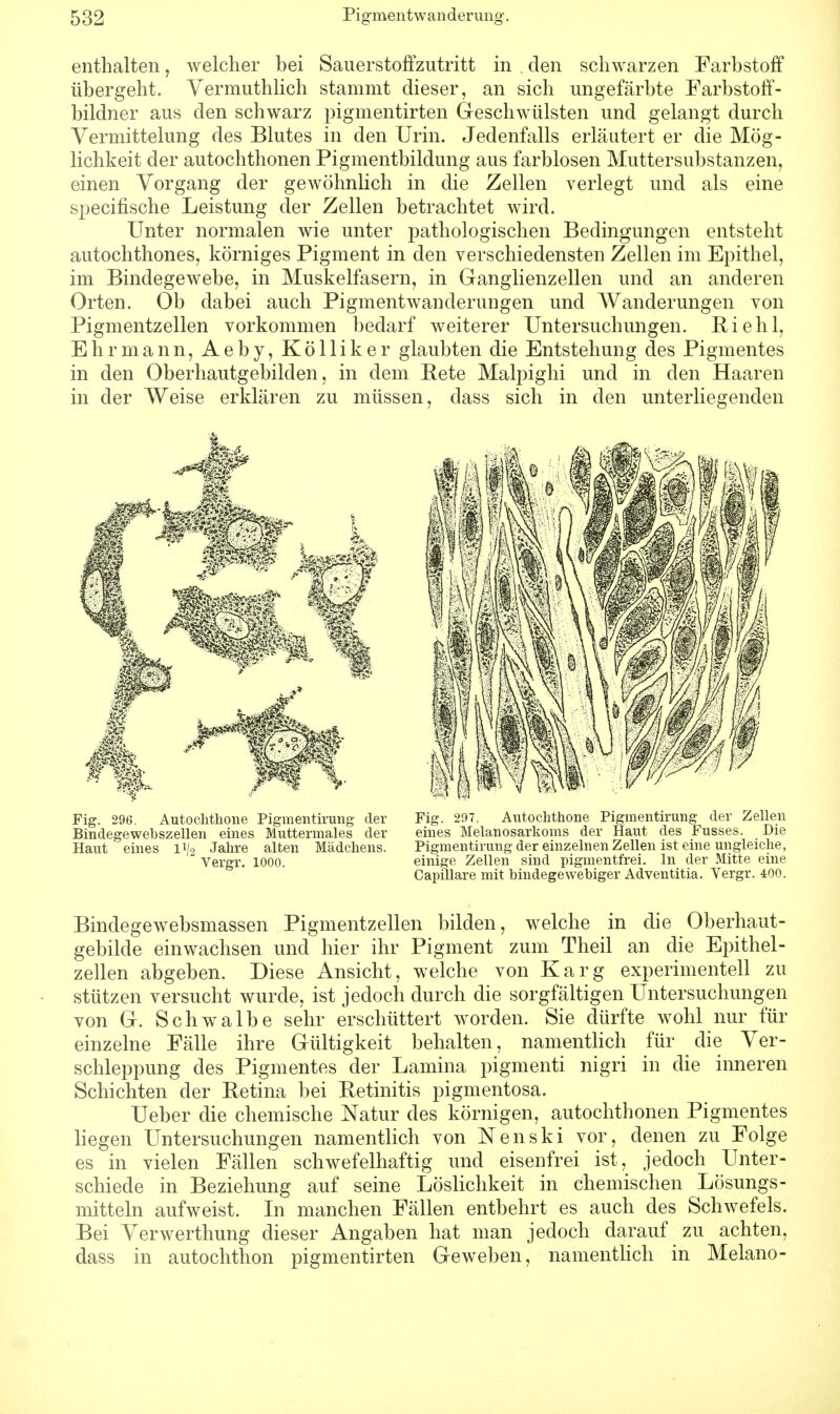 enthalten, welcher bei Sauerstoffzutritt in . den schwarzen Farbstoff übergeht. Vermuthlich stammt dieser, an sich ungefärbte Farbstoff- bildner aus den schwarz pigmentirten Geschwülsten und gelangt durch Vermittelung des Blutes in den Urin. Jedenfalls erläutert er die Mög- lichkeit der autochthonen Pigmentbildung aus farblosen Mutter Substanzen, einen Vorgang der gewöhnlich in die Zellen verlegt und als eine specifische Leistung der Zellen betrachtet wird. Unter normalen wie unter pathologischen Bedingungen entsteht autochthones, körniges Pigment in den verschiedensten Zellen im Epithel, im Bindegewebe, in Muskelfasern, in Ganglienzellen und an anderen Orten. Ob dabei auch Pigmentwanderungen und Wanderungen von Pigmentzellen vorkommen bedarf weiterer Untersuchungen. Riehl, Ehr mann, Aeby, Kölliker glaubten die Entstehung des Pigmentes in den Oberhautgebilden, in dem Rete Malpighi und in den Haaren in der Weise erklären zu müssen, dass sich in den unterliegenden Fig. 296. Autochthone Pigmentirung der Fig. 297. Autochthone Pigmentirung der Zellen Bindegewebszellen eines Muttermales der eines Melanosarkoms der Haut des Fusses. Die Haut eines 11/9 Jahre alten Mädchens. Pigmentirung der einzelnen Zellen ist eine ungleiche,  Vergr. 1000. einige Zellen sind pigmentfrei. In der Mitte eine Capillare mit bindegewebiger Adventitia. Vergr. 400. Bindegewebsmassen Pigmentzellen bilden, welche in die Oberhaut- gebilde einwachsen und hier ihr Pigment zum Theil an die Epithel- zellen abgeben. Diese Ansicht, welche von Karg experimentell zu stützen versucht wurde, ist jedoch durch die sorgfältigen Untersuchungen von G. Schwalbe sehr erschüttert worden. Sie dürfte wohl nur für einzelne Fälle ihre Gültigkeit behalten, namentlich für die Ver- schleppung des Pigmentes der Lamina pigmenti nigri in die inneren Schichten der Retina bei Retinitis pigmentosa. Ueber die chemische Natur des körnigen, autochthonen Pigmentes liegen Untersuchungen namentlich von Nenski vor, denen zu Folge es in vielen Fällen schwefelhaftig und eisenfrei ist, jedoch Unter- schiede in Beziehung auf seine Löslichkeit in chemischen Lösungs- mitteln aufweist. In manchen Fällen entbehrt es auch des Schwefels. Bei Verwerthung dieser Angaben hat man jedoch darauf zu achten, dass in autochthon pigmentirten Geweben, namentlich in Melano-