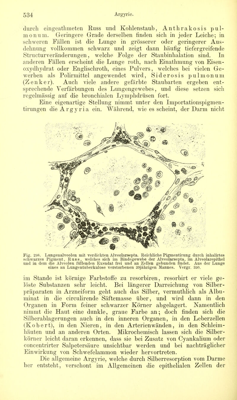 durch eingeathmeten Russ und Kohlenstaub, Anthrakosis pul- monum. Geringere Grade derselben finden sich in jeder Leiche; in schweren Fällen ist die Lunge in grösserer oder geringerer Aus- dehnung vollkommen schwarz und zeigt dann häufig tiefergreifende Structurveränderungen, welche Folge der Staubinhalation sind. In anderen Fällen erscheint die Lunge roth, nach Einathmung von Eisen- oxyclhydrat oder Englischroth, eines Pulvers, welches bei vielen Ge- werben als Polirmittel angewendet wird, Siderosis pulmonum (Zenker). Auch viele andere gefärbte Staubarten ergeben ent- sprechende Verfärbungen des Lungengewebes, und diese setzen sich regelmässig auf die bronchialen Lymphdrüsen fort. Eine eigenartige Stellung nimmt unter den Importationspigmen- tirungen die A r g y r i a ein. Während, wie es scheint, der Darm nicht Fig. 298. Lutigenalveolen mit verdickten Alveolarsepta. Reichliche Pigmentirung durch inhalirtes schwarzes Pigment, Russ, welches sich im Bindegewebe der Alveolarsepta, im Alveolarepithel und in dem die Alveolen füllenden Exsudat frei und an Zellen gebunden findet. Aus der Lunge eines an Lungentuberkulose verstorbenen 39jährigen Mannes. Vergr. 330. im Stande ist körnige Farbstoffe zu resorbiren, resorbirt er viele ge- löste Substanzen sehr leicht. Bei längerer Darreichung von Silber- präparaten in Arzneiform geht auch das Silber, vermuthlich als Albu- minat in die circulirende Säftemasse über, und wird dann in den Organen in Form feiner schwarzer Körner abgelagert. Namentlich nimmt die Haut eine dunkle, graue Farbe an; doch finden sich die Silberablagerungen auch in den inneren Organen, in den Leberzellen (Kobert), in den Nieren, in den Arterien wänden, in den Schleim- häuten und an anderen Orten. Mikrochemisch lassen sich die Silber- körner leicht daran erkennen, class sie bei Zusatz von Cyankalium oder concentrirter Salpetersäure unsichtbar werden und bei nachträglicher Einwirkung von Schwefelammon wieder hervortreten. Die allgemeine Argyrie, welche durch Silberresorption vom Darme her entsteht, verschont im Allgemeinen die epithelialen Zellen der