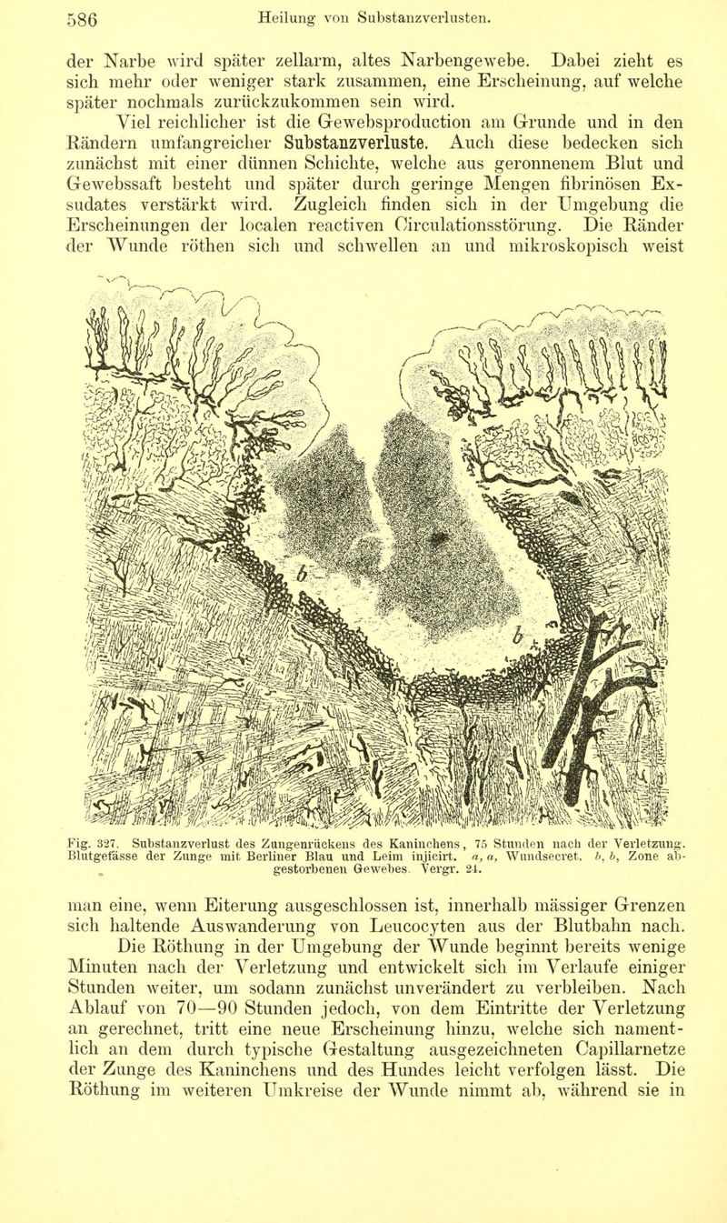 der Narbe wird später zellarm, altes Narbengewebe. Dabei zieht es sich mehr oder weniger stark zusammen, eine Erscheinung, auf welche später nochmals zurückzukommen sein wird. Viel reichlicher ist die Gewebsproduction am Grunde und in den Rändern umfangreicher Substanzverluste. Auch diese bedecken sich zunächst mit einer dünnen Schichte, welche aus geronnenem Blut und Gewebssaft besteht und später durch geringe Mengen fibrinösen Ex- sudates verstärkt wird. Zugleich finden sich in der Umgebung die Erscheinungen der localen reactiven Oirculationsstörung. Die Ränder der Wunde röthen sich und schwellen an und mikroskopisch weist Fig. 327. Substanzverlust des Zungenrückens des Kaninchens, 75 Stunden nach der Verletzung. Blutgefässe der Zunge mit Berliner Blau und Leim injicirt. a, a, Wundsecret. b, b, Zone ab- gestorbenen Gewebes. Yergr. 2-i. man eine, wenn Eiterung ausgeschlossen ist, innerhalb mässiger Grenzen sich haltende Auswanderung von Leucocyten aus der Blutbahn nach. Die Röthung in der Umgebung der Wunde beginnt bereits wenige Minuten nach der Verletzung und entwickelt sich im Verlaufe einiger Stunden weiter, um sodann zunächst unverändert zu verbleiben. Nach Ablauf von 70—90 Stunden jedoch, von dem Eintritte der Verletzung an gerechnet, tritt eine neue Erscheinung hinzu, welche sich nament- lich an dem durch typische Gestaltung ausgezeichneten Capillarnetze der Zunge des Kaninchens und des Hundes leicht verfolgen lässt. Die Röthung im weiteren Umkreise der Wunde nimmt ab, während sie in
