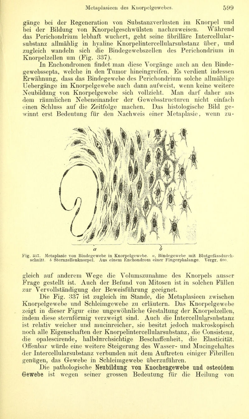 gänge bei der Regeneration von Substanz Verlusten im Knorpel und bei der Bildung von Knorpelgeschwülsten nachzuweisen. Während das Perichondrium lebhaft wuchert, geht seine fibrilläre Intercellular- substanz allmählig in hyaline Knorpelintercellularsubstanz über, und zugleich wandeln sich die Bindegewebszellen des Perichondrium in Knorpelzellen um (Fig. 337). In Enchondromen findet man diese Vorgänge auch an den Binde - gewebssepta, welche in den Tumor hineingreifen. Es verdient indessen Erwähnung, dass das Bindegewebe des Perichondrium solche allmählige Uebergänge im Knorpelgewebe auch dann aufweist, wenn keine weitere Neubildung von Knorpelgewebe sich vollzieht. Man darf daher aus dem räumlichen Nebeneinander der Gewebsstructuren nicht einfach einen Schluss auf die Zeitfolge machen. Das histologische Bild ge- winnt erst Bedeutung für den Nachweis einer Metaplasie, wenn zu- gleich auf anderem Wege die Volumszunahme des Knorpels ausser Frage gestellt ist. Auch der Befund von Mitosen ist in solchen Fällen zur Vervollständigung der Beweisführung geeignet. Die Fig. 337 ist zugleich im Stande, die Metaplasieen zwischen Knorpelgewebe und Schleimgewebe zu erläutern. Das Knorpelgewebe zeigt in dieser Figur eine ungewöhnliche Gestaltung der Knorpelzellen, indem diese sternförmig verzweigt sind. Auch die Intercellularsubstanz ist relativ weicher und mucinreicher, sie besitzt jedoch makroskopisch noch alle Eigenschaften der Knorpelintercellularsubstanz, die Gonsistenz, die opalescirende, halbdurchsichtige Beschaffenheit, die Elasticität. Offenbar würde eine weitere Steigerung des Wasser- und Mucingehaltes der Intercellularsubstanz verbunden mit dem Auftreten einiger Fibrillen genügen, das Gewebe in Schieimgewebe überzuführen. Die pathologische Neubildung von Knochengewebe und osteoidem Gewebe ist wegen seiner grossen Bedeutung für die Heilung von