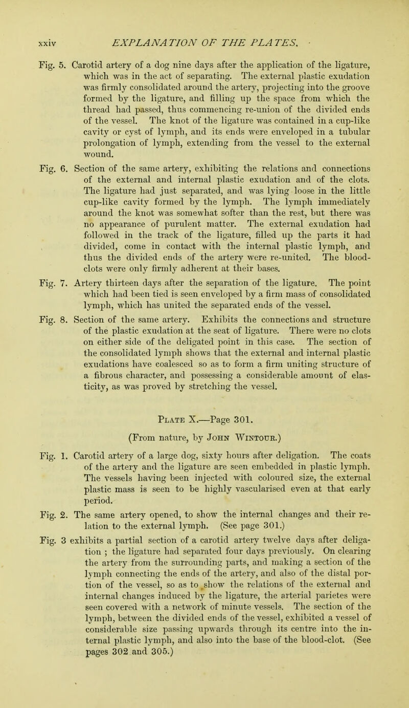 Fig. 5. Carotid artery of a dog nine days after the application of the ligature, which was in the act of separating. The external plastic exudation was firmly consolidated around the artery, projecting into the groove formed by the ligature, and filling up the space from which the thread had passed, thus commencing re-union of the divided ends of the vessel. The knot of the ligature was contained in a cup-like cavity or cyst of lymph, and its ends were enveloped in a tubular prolongation of lymph, extending from the vessel to the external wound. Section of the same artery, exhibiting the relations and connections of the external and internal plastic exudation and of the clots. The ligature had just separated, and was lying loose in the little cup-like cavity formed by the lymph. The lymph immediately around the knot was somewhat softer than the rest, but there was no appearance of purulent matter. The external exudation had followed in the track of the ligature, filled up the parts it had divided, come in contact with the internal plastic lymph, and thus the divided ends of the artery were re-united. The blood- clots were only firmly adherent at their bases. Artery thirteen days after the separation of the ligature. The point which had been tied is seen enveloped by a firm mass of consolidated lymph, which has united the separated ends of the vessel. Section of the same artery. Exhibits the connections and structure of the plastic exudation at the seat of ligature. There were no clots on either side of the deligated point in this case. The section of the consolidated lymph shows that the external and internal plastic exudations have coalesced so as to form a firm uniting structure of a fibrous character, and possessing a considerable amount of elas- ticity, as was proved by stretching the vessel. Plate X.—Page 301. (From nature, by John Wintour.) Fig. I. Carotid artery of a large dog, sixty hours after deligation. The coats of the artery and the ligature are seen embedded in plastic lymph. The vessels having been injected with coloured size, the external plastic mass is seen to be highly vascularised even at that early period. Fig. 2. The same artery opened, to show the internal changes and their re- lation to the external lymph. (See page 301.) Fig. 3 exhibits a partial section of a carotid artery twelve days after deliga- tion ; the ligature had separated four days previously. On clearing the artery from the surrounding parts, and making a section of the lymph connecting the ends of the artery, and also of the distal por- tion of the vessel, so as to _show the relations of the external and internal changes induced by the ligature, the arterial imiietes were seen covered with a network of minute vessels. The section of the lymph, between the divided ends of the vessel, exhibited a vessel of considerable size passing upwards through its centre into the in- ternal plastic lymph, and also into the base of the blood-clot. (See pages 302 and 305.) Fig. 6. Fig. 7. Fig. 8.