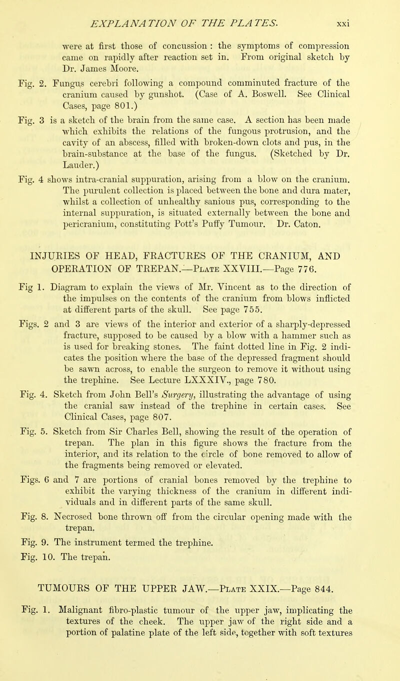 were at first those of concussion : the symptoms of compression came on rapidly after reaction set in. From original sketch hy Dr. James Moore. Fig. 2. Fungus cerebri following a compound comminuted fracture of the cranium caused by gunshot. (Case of A. Boswell. See Clinical Cases, page 801.) Fig. 3 is a sketch of the brain from the same case. A section has been made which exhibits the relations of the fungous protrusion, and the cavity of an abscess, filled with broken-down clots and pus, in the brain-substance at the base of the fungus. (Sketched by Dr. Lauder.) Fig. 4 shows intra-cranial suppuration, arising from a blow on the cranium. The purulent collection is placed between the bone and dura mater, whilst a collection of unhealthy sanious pus, corresponding to the internal suppuration, is situated externally between the bone and pericranium, constituting Pott's Puffy Tumour. Dr. Caton. INJUEIES OF HEAD, FRACTURES OF THE CRANIUM, AND OPERATION OF TREPAN.—Plate XXVIII.—Page 776. Fig 1. Diagram to explain the views of Mr. Vincent as to the direction of the impulses on the contents of the cranium from blows inflicted at different parts of the skull. See page 755. Figs. 2 and 3 are views of the interior and exterior of a sharply-depressed fracture, supposed to be caused by a blow with a hammer such as is used for breaking stones. The faint dotted line in Fig. 2 indi- cates the position where the base of the depressed fragment should be sawn across, to enable the surgeon to remove it without using the trephine. See Lecture LXXXIV., page 780. Fig. 4. Sketch from John Bell's Surgery, illustrating the advantage of using the cranial saw instead of the trephine in certain cases. See Clinical Cases, page 807. Fig. 5. Sketch from Sir Charles Bell, showing the result of the operation of trepan. The plan in this figure shows the fracture from the interior, and its relation to the c'rcle of bone removed to allow of the fragments being removed or elevated. Figs. 6 and 7 are portions of cranial bones removed by the trephine to exhibit the varying thickness of the cranium in different indi- viduals and in different parts of the same skull. Fig. 8. Necrosed bone thrown off from the circular opening made with the trepan. Fig. 9. The instrument termed the trephine. Fig. 10. The trepan. TUMOURS OF THE UPPER JAW.—Plate XXIX.—Page 844. Fig. 1, Malignant fibro-plastic tumour of the upper jaw, implicating the textures of the cheek. The upper jaw of the right side and a portion of palatine plate of the left side, together with soft textures