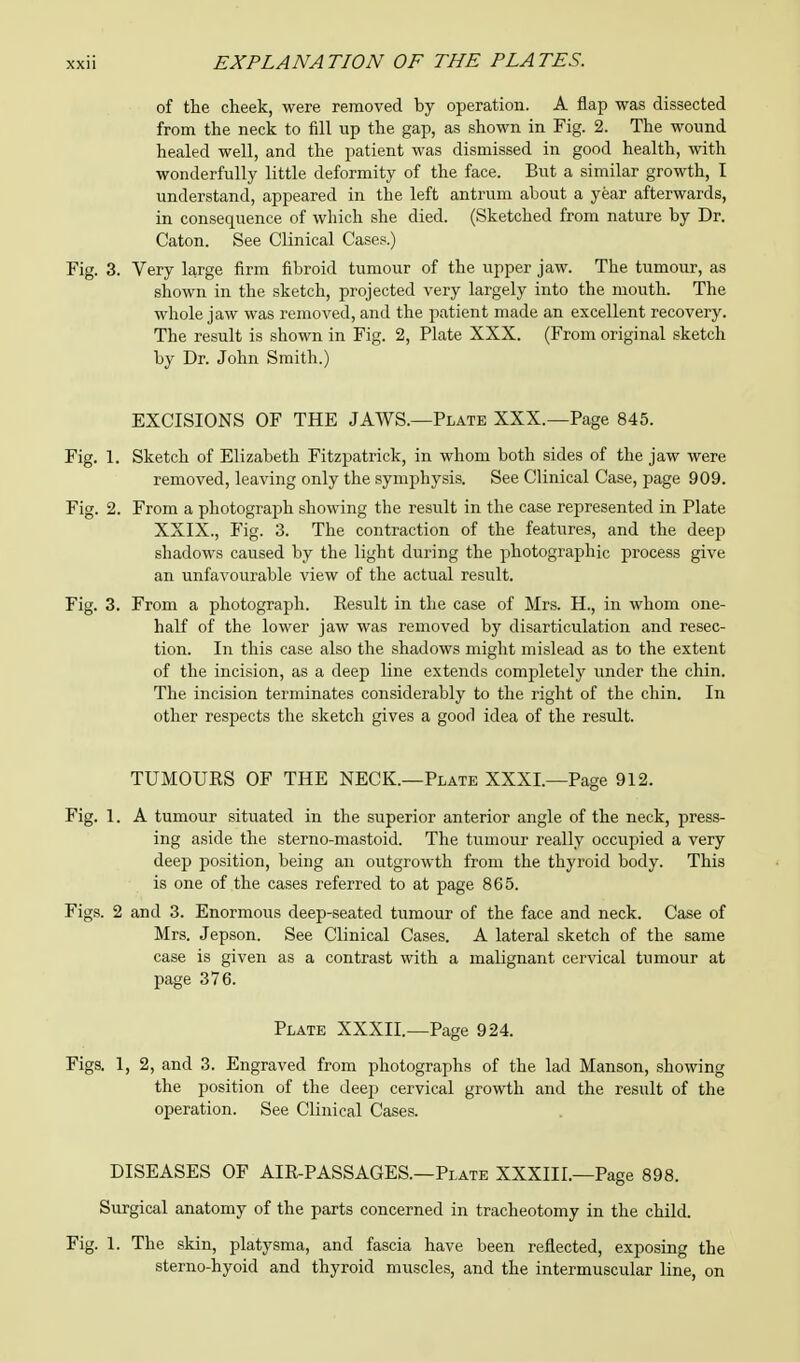 of the cheek, were removed by operation. A flap was dissected from the neck to fill up the gap, as shown in Fig. 2. The wound healed well, and the patient was dismissed in good health, with wonderfully little deformity of the face. But a similar growth, I understand, appeared in the left antrum about a year afterwards, in consequence of which she died. (Sketched from nature by Dr. Caton. See Clinical Cases.) Fig. 3. Very large firm fibroid tumour of the upper jaw. The tumour, as shown in the sketch, projected very largely into the mouth. The whole jaw was removed, and the patient made an excellent recovery. The result is shown in Fig. 2, Plate XXX. (From original sketch by Dr. John Smith.) EXCISIONS OF THE JAWS.—Plate XXX.—Page 845. Fig. 1. Sketch of Elizabeth Fitzpatrick, in whom both sides of the jaw were removed, leaving only the symphysis. See Clinical Case, page 909. Fig. 2. From a photograph showing the result in the case represented in Plate XXIX., Fig. 3. The contraction of the features, and the deep shadows caused by the light during the photographic process give an unfavourable view of the actual result. Fig. 3. From a photograph. Result in the case of Mrs. H., in whom one- half of the lower jaw was removed by disarticulation and resec- tion. In this case also the shadows might mislead as to the extent of the incision, as a deep line extends completely under the chin. The incision terminates considerably to the right of the chin. In other respects the sketch gives a good idea of the result. TUMOURS OF THE NECK.—Plate XXXI.—Page 912. Fig. 1. A tumour situated in the superior anterior angle of the neck, press- ing aside the sterno-mastoid. The tumour really occupied a very deep position, being an outgrowth from the thyroid body. This is one of the cases referred to at page 865. Figs. 2 and 3. Enormous deep-seated tumour of the face and neck. Case of Mrs. Jepson. See Clinical Cases. A lateral sketch of the same case is given as a contrast with a malignant cervical tumour at page 376. Plate XXXII.—Page 924. Figs. 1, 2, and 3. Engraved from photographs of the lad Manson, showing the position of the deep cervical growth and the result of the operation. See Clinical Cases. DISEASES OF AIR-PASSAGES.—Plate XXXIII.—Page 898. Surgical anatomy of the parts concerned in tracheotomy in the child. Fig. 1. The skin, platysma, and fascia have been reflected, exposing the sterno-hyoid and thyroid muscles, and the intermuscular line, on