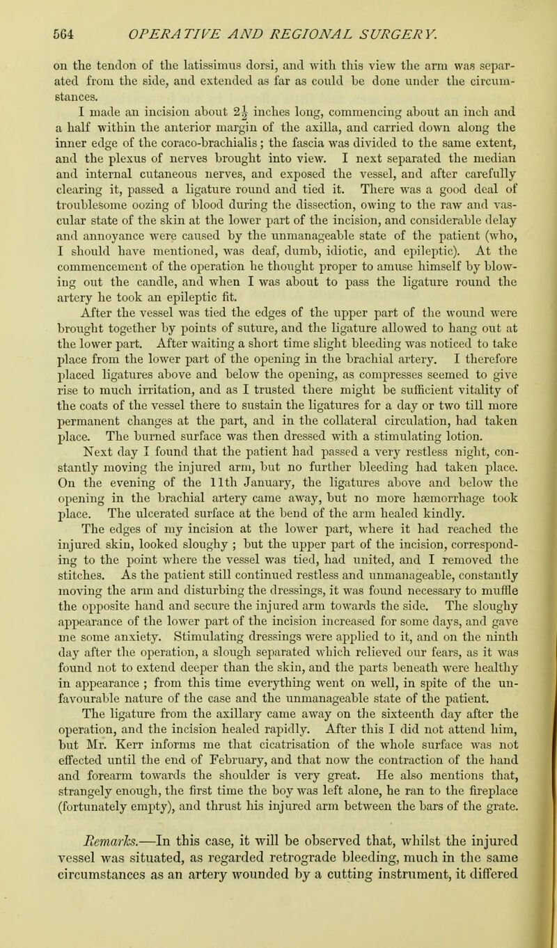 on the tendon of tlie latissimus dorsi, and with this view the arm was separ- ated from the side, and extended as far as could be done under the circum- stances. I made an incision about 2j inches long, commencing about an inch and a half within the anterior margin of the axilla, and carried down along the inner edge of the coraco-brachialis; the fascia was divided to the same extent, and the plexus of nerves brought into view. I next separated the median and internal cutaneous nerves, and exposed the vessel, and after carefully clearing it, passed a ligature round and tied it. There was a good deal of troublesome oozing of blood during the dissection, owing to the raw and vas- cular state of the skin at the lower part of the incision, and considerable delay and annoyance were caused by the unmanageable state of the patient (who, I should have mentioned, was deaf, dumb, idiotic, and epileptic). At the commencement of the operation he thought proper to amuse himself by blow- ing out the candle, and when I was about to pass the ligature round the artery he took an epileptic fit. After the vessel was tied the edges of the upper part of the wound were brought together by points of suture, and the ligature allowed to hang out at the lower part. After waiting a short time slight bleeding was noticed to take place from the lower part of the opening in the brachial artery. I therefore placed ligatures above and below the opening, as compresses seemed to give rise to much irritation, and as I trusted there might be sufficient vitality of the coats of the vessel there to sustain the ligatures for a day or two till more permanent changes at the part, and in the collateral circulation, had taken place. The burned surface was then dressed with a stimulating lotion. Next day I found that the patient had passed a very restless night, con- stantly moving the injured arm, but no further bleeding had taken place. On the evening of the 11th January, the ligatures above and below the opening in the brachial artery came away, but no more haemorrhage took place. The idcerated surface at the bend of the arm healed kindly. The edges of my incision at the lower part, where it had reached the injured skin, looked sloughy ; but the upper part of the incision, correspond- ing to the point where the vessel was tied, had united, and I removed the stitches. As the patient still continued restless and unmanageable, constantly moving the arm and disturbing the dressings, it was found necessary to muffle the opposite hand and secure the injured arm towards the side. The sloughy appearance of the lower part of the incision increased for some days, and gave me some anxiety. Stimulating dressings were applied to it, and on the ninth day after the operation, a slough separated which relieved our fears, as it was found not to extend deeper than the skin, and the parts beneath were healthy in appearance ; from this time everything went on well, in spite of the un- favourable nature of the case and the unmanageable state of the patient. The ligature from the axillary came away on the sixteenth day after the operation, and the incision healed rapidly. After this I did not attend him, but Mr. Kerr informs me that cicatrisation of the whole surface was not effected until the end of February, and that now the contraction of the hand and forearm towards the shoulder is very great. He also mentions that, strangely enough, the first time the boy was left alone, he ran to the fireplace (fortunately empty), and thrust his injured arm between the bars of the grate. Remarks.—In this case, it will be observed that, whilst the injured vessel was situated, as regarded retrograde bleeding, much in the same circumstances as an artery wounded by a cutting instrument, it differed