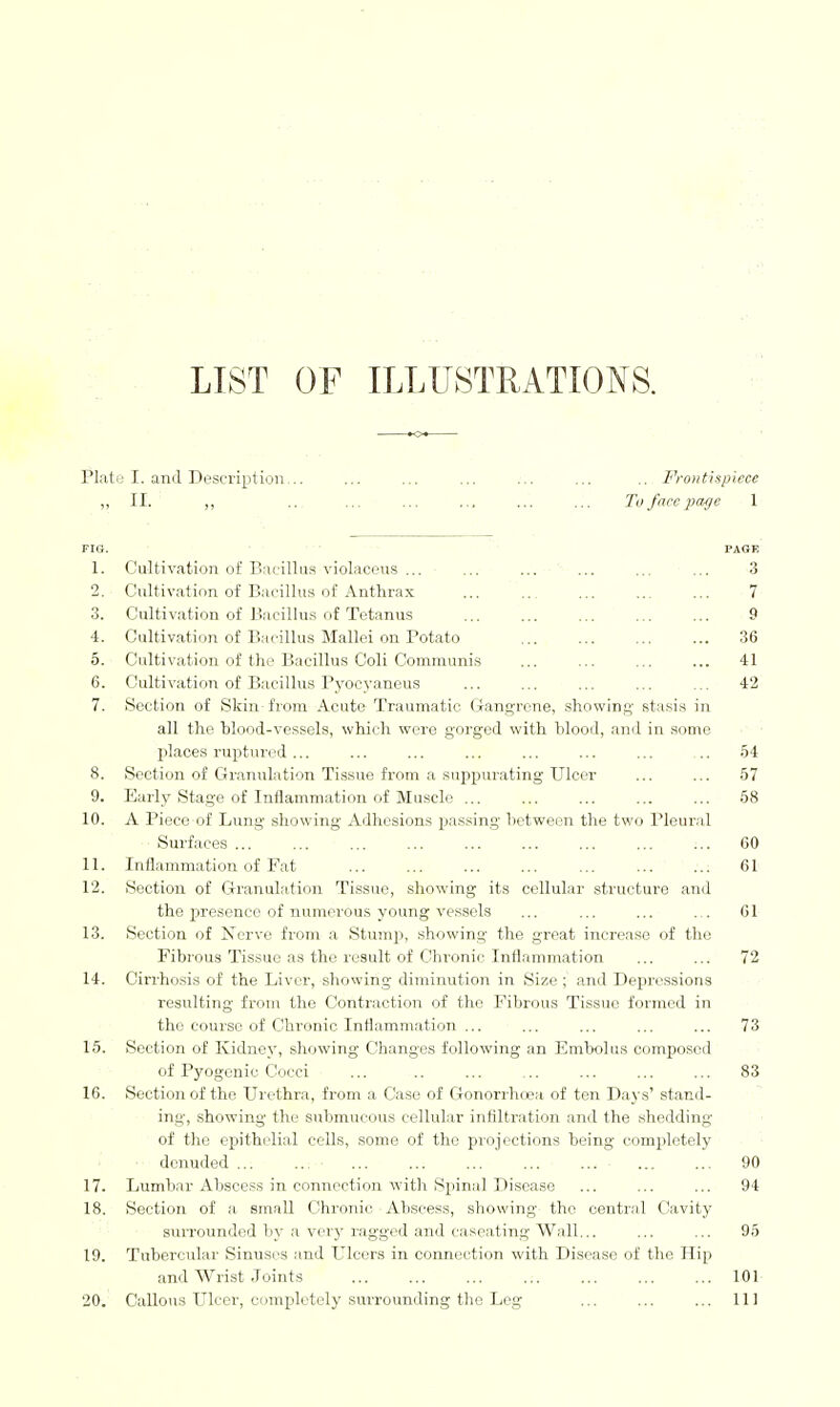 LIST OF ILLUSTRATIONS. Plato I. and Description,.. ... ... ... ;.. ... .. Frontispiece „ II. ,, ... ... ■ ... ... ... ... To/tree pa^jie 1 FIG. PAGE 1. Cultivation of Bacillus violaceus ... ... ... ' ... ... ■ ... 3 2. Cultivation of Bacillus of Anthrax 7 3. Cultivation of Bacillus of Tetanus 9 4. Cultivation of Bacillus Mallei on Potato 36 5. Cultivation of the Bacillus Coli Communis 41 6. Cultivation of Bacillus Pvocvaneus 42 7. Section of Skin fi'om Acute Traumatic Grangrene, showing stasis in all tho blood-vessels, which were gorged with hlood, and in some places ruptured ... 54 8. Section of Granulation Tissue from a suppurating Ulcer 57 9. Early Stage of Inflammation of Muscle ... 58 10. A Piece of Lung showing Adhesions passing hotweon the two Pleural Surfaces ... 60 11. Inflammation of Fat 61 12. Section of Granulation Tissue, showing its cellular structure and the presence of numerous young vessels 61 13. Section of Nerve from a Stumji, showing the great increase of the Fibrous Tissue as the result of Chronic Inflammation 72 14. Cirrhosis of the Liver, showing diminution in Size ; and Depressions resulting from the Contraction of tho Fibrous Tissue formed in tho course of Chronic Inflammation ... 73 15. Section of Kidne}', showing Changes following an Embolus composed of Pyogenic Cocci 83 16. Section of tho Urethra, from a Case of Gonorrhcca of ten Days' stand- ing, showing the submucous cellular infiltration and the shedding of the epithelial colls, some of the projections being completely denuded... ... 90 17. Lumbar Abscess in connection with Spinal Disease 94 18. Section of a small Chronic Abscess, showing the central CJavity surrounded by a ver}' ragged and caseating Wall... 95 19. Tubercular Sinuses and Ulcers in connection with Disease of the Hip and Wrist Joints 101 20. Callous LHcer, completely surrounding the Leg 111