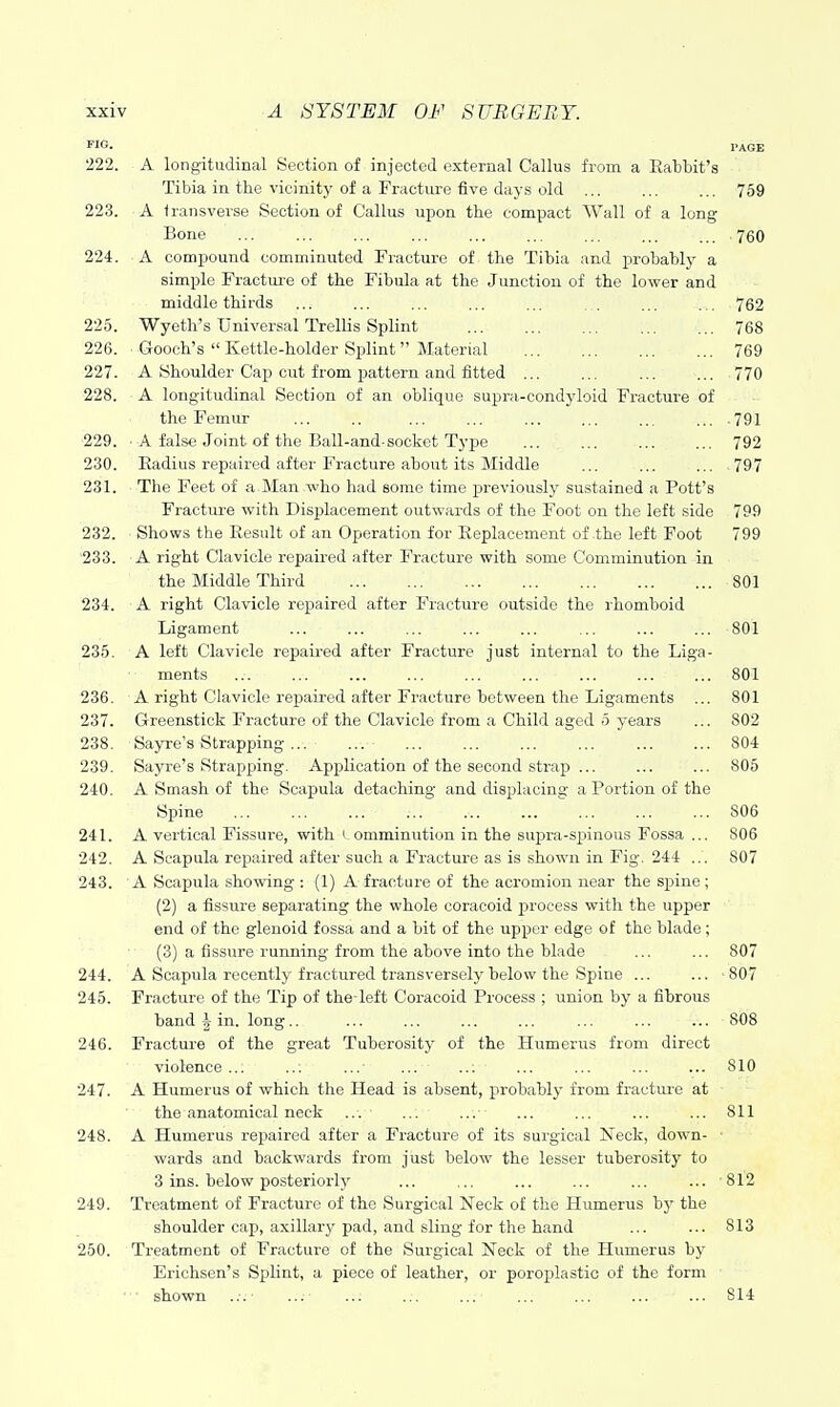 FIG. PAGE 222. A longitudinal Section of injected external Callus from a Rabbit's Tibia in the vicinity of a Fracture five days old ... 759 223. A transverse Section of Callus upon the compact AVall of a long Bone 760 224. A compound comminuted Fracture of the Tibia and probably a simple Fractm-e of the Fibula at the Junction of the lower and middle thirds ... ... ... ... ... . . ... ... 762 225. Wyeth's Universal Trellis Splint 768 226. ■ Gooch's  Kettle-holder Splint Material 769 227. A Shoulder Cap cut from pattern and fitted ... ... 770 228. A longitudinal Section of an oblique supra-condyloid Fracture of the Femur .791 229. ■ A false Joint of the Ball-and-socket Type 792 230. Eadius repaired after Fracture about its Middle ... ... ... 797 231. The Feet of a Man who had some time jjreviously sustained a Pott's Fracture with Displacement outwards of the Foot on the left side 799 232. Shows the Result of an Operation for Replacement of the left Foot 799 '233. A right Clavicle repaired after Fracture with some Comminution in the Middle Third 801 234. A right Clavicle repaired after Fracture outside the rhomboid Ligament ... ... ... ... ... ... ... ... 801 235. A left Clavicle repaired after Fracture just internal to the Liga- ments ... ... ... ... ... ... ... ... ... 801 236. A right Clavicle repaired after Fracture between the Ligaments ... 801 237. Greenstick Fracture of the Clavicle from a Child aged 5 years ... 802 238. Sayre's Strapping ... ... ... ... ... ... ... ... 804 239. Sayre's Strapping. Application of the second strap ... ... ... 805 240. A Smash of the Scapula detaching and disj)lacing a Portion of the Spine ... ... ... ... ... ... ... ... ... 806 241. A vertical Fissure, with omminution in the supra-spinous Fossa ... 806 242. A Scapula repaired after such a Fracture as is shown in Fig. 244 ... 807 243. A Scapula showing : (1) A fracture of the aci'omion near the spine ; (2) a fissure separating the whole coracoid process with the upper end of the glenoid fossa and a bit of the upper edge of the blade; (3) a fissure running from the above into the blade ... ... 807 244. A Scapula recently fractured transversely below the Spine ... ... 807 245. Fracture of the Tip of the left Coracoid Process ; union by a fibrous band ^ in. long.. ... ... ... ... ... ... ... 808 246. Fracture of the great Tuberosity of the Humerus from direct violence ... ..; ... ... ... ... ... ... ... 810 247. A Humerus of which the Head is absent, probably from fi-acture at the anatomical neck ... ... ... ... ... ... ... 811 248. A Humerus repaired after a Fracture of its surgical Neck, dowm- wards and backwards from just below the lesser tuberosity to 3 ins. below posteriori)' ... ... ... ... ... ... 812 249. Treatment of Fracture of the Surgical Neck of the Humerus bj^ the shoulder cap, axillar}'pad, and sling for the hand ... ... 813 250. Treatment of Fracture of the Surgical Neck of the Humerus by Erichsen's Splint, a piece of leather, or poroplastic of the form shown ... ... ... ... ... ... ... ... ... 814