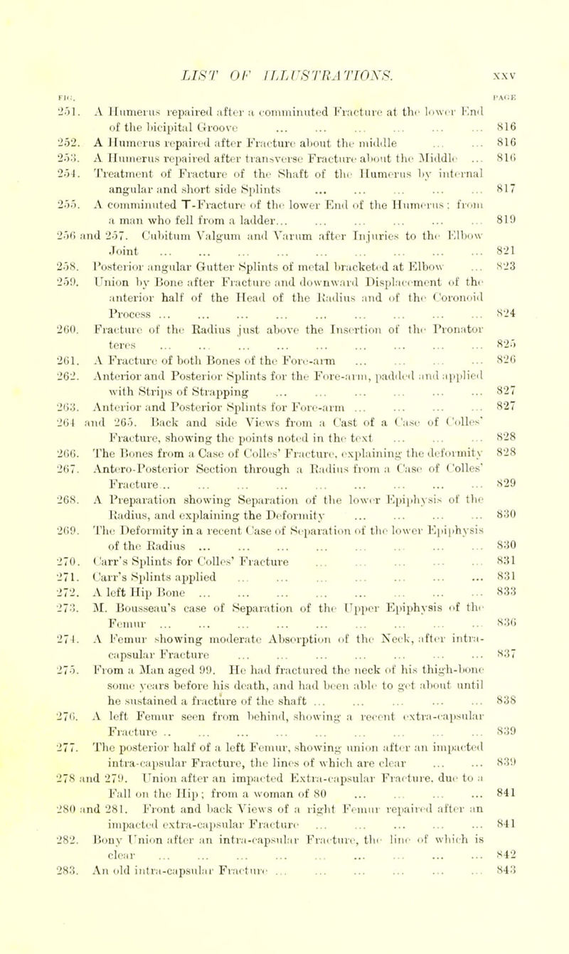 FK;. fAi;E 'iol. A Humeius repaired after a L'Omininnted Fracture at thi' li>\v< r Kml of the liicipital Groove ... ... ... ... ... ... S16 252. A Humerus repaireil after Fracture about the iiiidille ... ... 816 2o.'J. A Huuieru.s repaired after transverse Fracture aliout the ^Middle ... SKI 2.54. Treatment of Fracture of the Shaft of the IIumeru.'< l>y internal angular and .short side Splints ... ... ... ... ... 817 2oo. A comminuted T-Fraoture of the lower End of the Humerus; frnni a man who fell from a ladder... ... ... ... ... .. 819 2o6 and 2o7. Cuhitum Valgum and Varum after Injuries to the Klbow Joint 821 2.38. Posterior angular Gutter Splints of metal bracketed at Elbow ... 823 2.59. Union hy Bone after Fracture and downward Displacement of thi' .interior half of the Head of the lladius and of the Coronoid Process ... ... ... ... ... 824 260. Fracture of the Radius just above the Insertion of the Pronator teres 825 261. A Fracture of both Bones of the Fore-ann 826 262. Anterior and Posterior Splints for the Fore-arm, padded iind applied with Strips of Strapping ... ... ... ... ... ... 827 263. Anterior and Po.sterior Splints for Fore-arm ... ... ... ... 827 26- t and 265. Back and .side Views from a Cast of a Case of Colles' Fracture, showing the points noted in the text ... ... ... 828 266. The Bones from a Case of Colles' Fracture, explaining the deformity 828 267. Antero-Postorior Section through a Radius from a Case of (.'olles' Fracture 829 268. A Preparation showing Separation of the lower Hpi[ihysis of the Radius, and explaining the Deformity ... ... ... ... 830 269. The Deformity in a recent Case of Separation of the lower Epijihysis of the Radius 830 270. Carr's Splints for Colles'Fracture ... ... ... ... ... 831 271. Carr's Splints applied ... ... ... ... ... ... ... 831 272. A left Hip Bone 833 273. M. Bousseau'.s case of Separation of the Uiiper Epiphysis of thr Femur ... ... ... ... ... .. 836 27- 1. A Femur .showing moderate Absorption of th<' Neek, iifter intra- capsular Fracture ... ... ... ... ... ... ... '^37 275. Fiom a Man aged 99. He had fractured the neck of his thigh-bone some years before his death, and had been able to get about until he sn,stained a fracture of the shaft ... ... ... ... ... 838 276. A left Femur seen from liehind, showing a recent extii-e<apsular Fracture 839 277. The posterior half of ;i left Femur, showing union after an impacted intra-capsnlar Fracture, the lines of which are clear ... ... 839 278 and 279. Union after an impacted Extra-i'apsular Fiar ture. dui' to ;i Fall on the Hip ; from a woman of 80 ... ... ... ... 841 280 iind 281. Front and back Views of a right Femur repaired after an impacted e.xtra-capsular Fracture ... ... ... ... ... 841 282. Bony T^nion rrftcr an intra-capsul.'ir Fracture, tlir line of which is clear ... ... ... ... ... ... ... ... ... 842 283. An (dd iiitra-capsul.'ir Fr,-ie(iuc 843