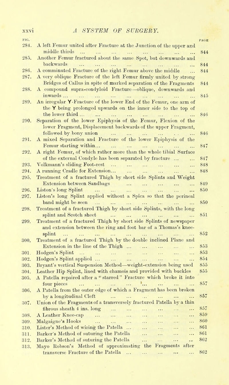 FIG. PAGE 284. A left Femur united after Fracture at the Junction of the upper and middle thirds 844 285. Another Femur fractured about the same Sijot, but downwards and backwards ... ... ... ... ... ... ... ... 844 286. A comminuted Fracture of the right Femur above the middle ... 844 287. A very oblique Fracture of the left Femur firmly united bj- strong Bridges of Callus in spite of marked separation of the Fragments 844 288. A compound supra-condyloid Fracture—oblique, downwards and inwards ... ... ... ... ... ... ... ... ... 845 289. An irregular Y-Fracture of the lower End of the Femur, one arm of the Y being prolonged upwards on the inner side to the top of the lower third 846 290. Separation of the lower Epiphysis of the Femur, Flexion of the lower Fragment, Displacement backwards of the upper Fragment, followed by bony union ... ... ... ... . . ... 846 291. A mixed Separation and Fracture of the lower Epiphysis of the Femur starting within... ... ... ... ... ... ... 847 292. A right Femur, of which rather more than the whole tibial Surface of the e.xternal Condyle has been separated by fracture ... ... 847 293. Volkmann's sliding Foot-rest 848 294. A running Cradle for E.vtension... ... ... ... ... ... 848 295. Treatment of a fractured Thigh by short side Splints and Weight Extension between Sandbags ... ... ... ... ... 849 296. Liston's long Splint 850 297. Liston's long Splint applied without a Spica so that the perineal band might be seen ... ... ... ... ... ... ... 850 298. Treatment of a fractured Thigh by short side Splints, with the long- splint and Scotch sheet ... ... ... ... ... ... 851 299. Treatment of a fractured Thigh by short side Splints of newspaper and extension between the ring and foot bar of a Thomas's knee- splint ... ... 852 300. Treatment of a fractured Thigh by the double inclined Plane and Extension in the line of the Thigh ... ... ... ... ... 853 301. Hodgen's Splint 853 302. Hodgen's Splint applied ... ... ... ... ... ... ... 854 303. Bryant's vertical Suspension Method—weight-extension being used 855 304. Leather Hip Splint, lined with chamois and provided with buckles 855 305. A Patella repaired after a  starredFracture which broke it into four pieces ... ... ... ... ... ... ... 857 306. A Patella from the outer edge of which a Fragment has been broken by a longitudinal Cleft ... ... ... ... ... ... 857 307. Union of the Fragments of a transverselj' fractured Patella bj^ a thin fibrous sheath 4 ins. long ... ... ... ... ... ... 857 308. A Leather Knee-cap ... ... ... ... ... ... ... 859 309. Malgaigne's Hooks 860 310. Lister's Method of wiring the Patella 861 311. Barker's Method of suturing the Patella 861 312. Barker's Method of suturing the Patella „ 862 313. jNIayo Robson's Method of approximating the Fragments after transverse Fracture of the Patella ... ... ... ... ... 862