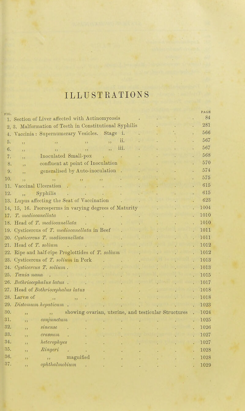 ILLUSTRATIONS KIO. 1. 2 4. 5. 6. 7. 8. 9. 10. 11. 12. 13. 14, 17. 18. 19. 20. 21. 22. 23. 24. 25. 26. 27. 28. 29. 30. 31. 32. 33. 34. 35. 36. 37. Section of Liver affected with Actinomycosis 3. Malformation of Teeth in Constitutional Syphilis Vaccinia : Supernumerary Vesicles. Stage ,; !) !> >! ,, Inoculated Small-pox ,, confluent at point of Inoculation ,, generalised by Auto-inoculation :, ;j )J :? Vaccinal Ulceration . „ Syphilis Lupus affecting the Seat of Vaccination 15, 16. Psorosperms in varying degrees of Maturity T. mediocanellata Head of T. mediocanellata Cysticercus of T. mediocanellata in Beef Cystieercus T. mediocanellata Head of T. solium Ripe and half-ripe Proglottides of T. solium Cysticercus of T. solittm in Pork Cysticercus T. solium . Tcenia nana Botlirioccphalus lotus . Head of Bothriocephalus lotus Larvse of Distomum hcpaticum . ,, showing ,, conjunctum ,, sinense ,, crassum ,, lieterophyes ,, Ringcri ,, ,, magnified ,, ophthalmobium ovarian, uterine, and testicular Structures