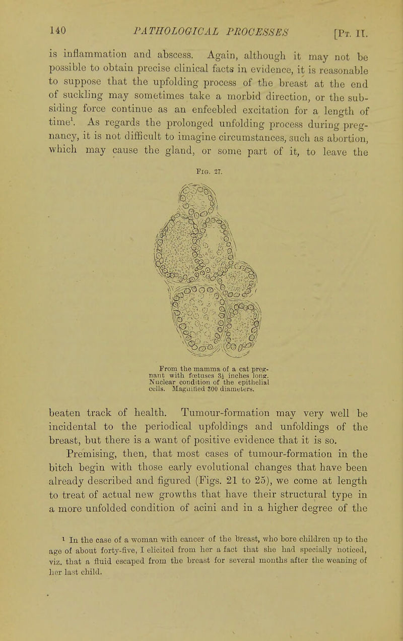 is inflammation and abscess. Again, although it may not be possible to obtain precise clinical facts in evidence, it is reasonable to suppose that the upfolding process of the breast at the end of suckling may sometimes take a morbid direction, or the sub- siding force continue as an enfeebled excitation for a length of time\ As regards the prolonged unfolding process during preg- nancy, it is not difficult to imagine circumstances, such as abortion, which may cause the gland, or some part of it, to leave the Fig. 27. Prom the mamma of a cat preg- nant with foetuses 8J inches Ions:. Nuclear condition of the epitlielial culls. Magiiitied 300 diameters. beaten track of health. Tumour-formation may very well be incidental to the periodical upfoldings and unfoldings of the breast, but there is a want of positive evidence that it is so. Premising, then, that most cases of tumour-formation in the bitch begin with those early evolutional changes that have been already described and figured (Figs. 21 to 25), we come at length to treat of actual new growths that have their structural type in a more unfolded condition of acini and in a higher degree of the ^ In the case of a woman with cancer of the breast, who bore childi-en up to the age of about forty-five, I elicited from her a fact that she had specially noticed, viz. that a fluid escaped from the breast for several months after the weaning of her last child.