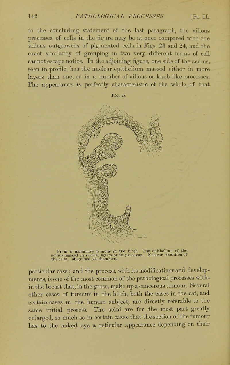 to the concluding statement of tlie last paragraph, the villous processes of cells in the figure may be at once compared with the villous outgrowths of pigmented cells in Figs. 23 and 24, and the exact similarity of grouping in two very different forms of cell cannot escape notice. In the adjoining figure, one side of the acinus, seen in profile, has the nuclear epithelium massed either iu more layers than one, or in a number of villous or knob-like processes. The appearance is perfectly characteristic of the whole of that Fio. 28. Prora a inanimary tumour in the bitch. The epithelium of the acinus massed in several layers or in processes. Nuclear condition of the cells. Masnilied 300 diameters. particular case ; and the process, with its modifications and develop- ments, is one of the most common of the pathological processes with- in the breast that, in the gross, make up a cancerous tumour. Several other cases of tumour in the bitch, both the cases in the cat, and certain cases in the human subject, are directly referable to the same initial process. The acini are for the most part greatly enlarged, so much so in certain cases that the section of the tumour has to the naked eye a reticular appearance depending on their