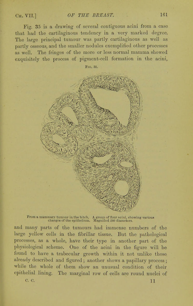 Fig. 35 is a drawing of several contiguous acini from a case that had the cartilaginous tendency in a very marked degree. The large principal tumour was partly cartilaginous as well as partly osseous, and the smaller nodules exemplified other processes as well. The fringes of the more or less normal mamma showed exquisitely the process of pigment-cell formation in the acini, Fig. 35. Prom a mammary tumour in the bitch. A group of four ncini, showing various changes of the epithelium. Magnified 240 diameters. and many parts of the tumours had immense numbers of the large yellow cells in the fibrillar tissue. But the pathological processes, as a whole, have their type in another part of the physiological scheme. One of the acini in the figure will be found to have a trabecular growth within it not unlike those already described and figured ; another shows a papillary process ; while the whole of them show an unusual condition of their epithelial lining. The marginal row of cells are round nuclei of c. c. 11