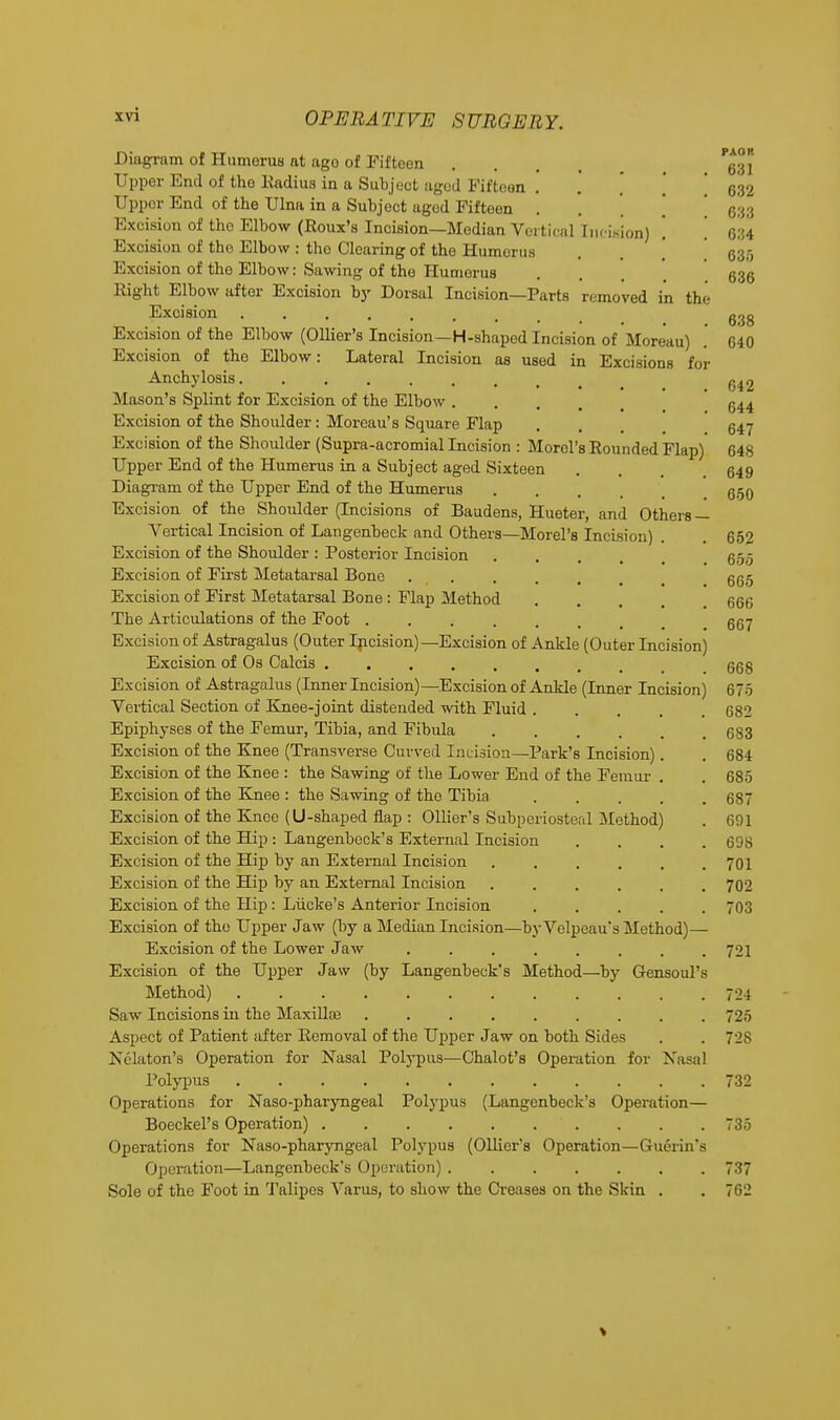 Diagram of Humerus at ago of Fifteen . . . Pg;°j 632 633 634 635 636 Upper End of tho Radius in a Subjeot aged Fifteen Upper End of the Ulna in a Subject agod Fifteen Excision of the Elbow (Roux's Incision—Median Vertical [iieifiion) Excision of the Elbow : tho Clearing of the Humerus Excision of the Elbow: Sawing of the Humerus Right Elbow after Excision by Dorsal Incision—Parts removed in the Excision ggg Excision of the Elbow (Ollier's Incision—H-shaped Incision of Moreau) .' 640 Excision of the Elbow: Lateral Incision as used in Excisions for Anchylosis ........ Mason's Splint for Excision of the Elbow .... 644 Excision of the Shoulder: Moreau's Square Flap . . 547 Excision of the Shoulder (Supra-acromial Incision : Morel's Rounded Flap) 648 Upper End of the Humerus in a Subject aged Sixteen . . , 649 Diagram of the Upper End of the Humerus . . . 650 Excision of the Shoulder (Incisions of Baudens, Hueter, and Others — Vertical Incision of Langenbeck and Others—Morel's Incision) . 652 Excision of the Shoulder: Posterior Incision . . . q-}- Excision of First Metatarsal Bone . . . . , §65 Excision of First Metatarsal Bone: Flap Method . . . 666 The Articulations of the Foot 667 Excision of Astragalus (Outer Incision)—Excision of Ankle (Outer Incision) Excision of Os Calcis ....... 668 Excision of Astragalus (Inner Incision)—Excision of Ankle (Inner Incision) 675 Vertical Section of Knee-joint distended with Fluid 682 Epiphyses of the Femur, Tibia, and Fibula 683 Excision of the Knee (Transverse Curved Incision—Park's Incision). . 684 Excision of the Knee : the Sawing of the Lower End of the Femur . . 685 Excision of the Knee : the Sawing of tho Tibia 687 Excision of the Knee (U-shaped flap : Ollier's Subperiosteal Method) . 691 Excision of the Hip : Langenbeck's External Incision .... 698 Excision of the Hip by an External Incision ...... 701 Excision of the Hip by an External Incision ...... 702 Excision of the Hip: Liicke's Anterior Incision 703 Excision of tho Upper Jaw (by a Median Incision—by Velpeau's Method)— Excision of the Lower Jaw . . . . . . . .721 Excision of the Upper Jaw (by Langenbeck's Method—by Gensoul's Method) 724 Saw Incisions in the Maxillaj 725 Aspect of Patient after Removal of the Upper Jaw on both Sides . . 728 Nekton's Operation for Nasal Polypus—Chalot's Operation for Nasal Polypus 732 Operations for Naso-pharyngeal Polypus (Langenbeck's Operation— Boeckel's Operation) . . . 735 Operations for Naso-pharyngeal Polypus (Ollier's Operation—Guferin's Operation—Langenbeck's Operation) 737 Sole of the Foot in Talipes Varus, to show the Creases on the Skin . . 762
