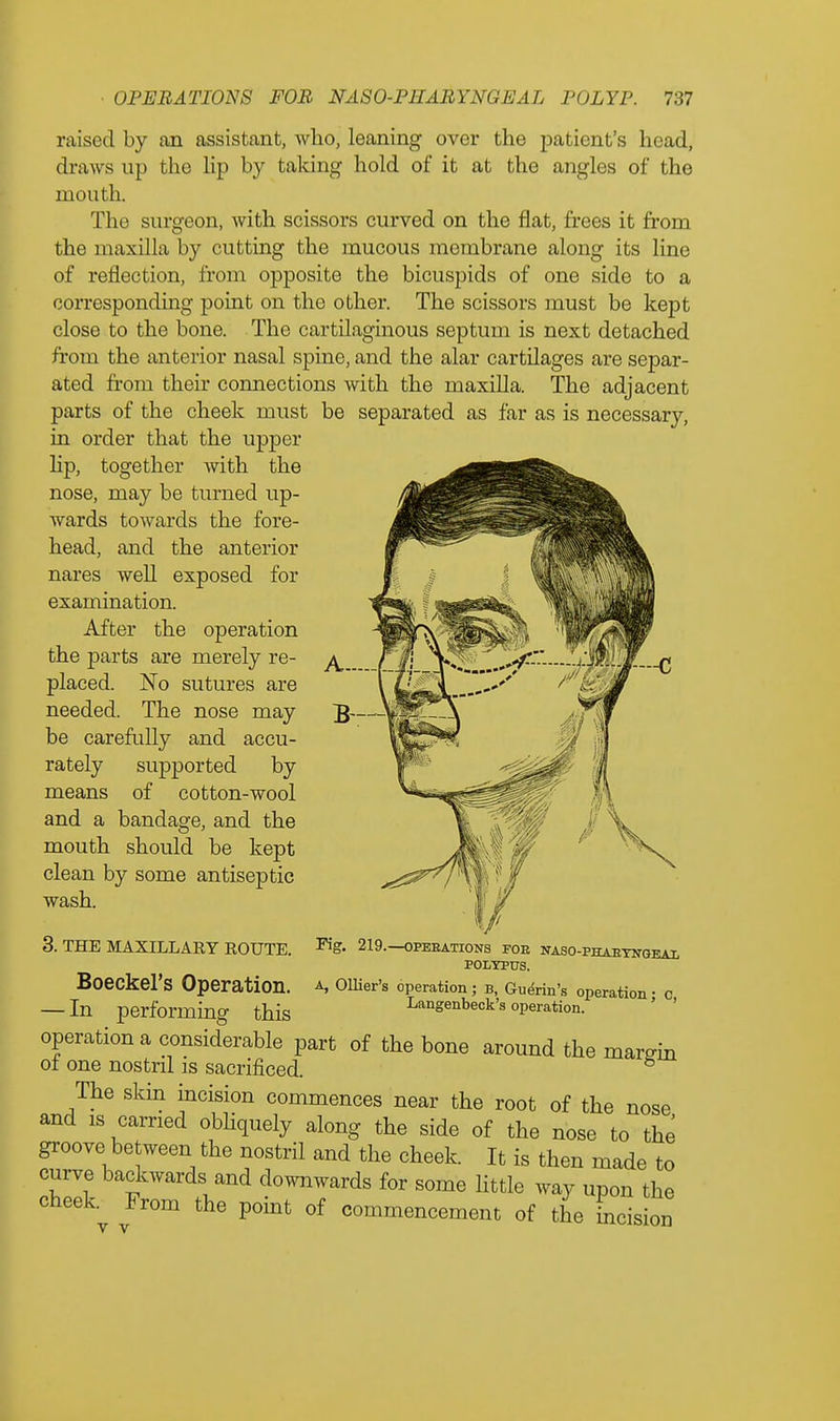 raised by an assistant, who, leaning over the patient's head, draws up the lip by taking hold of it at the angles of the mouth. The surgeon, with scissors curved on the flat, frees it from the maxilla by cutting the mucous membrane along its line of reflection, from opposite the bicuspids of one side to a corresponding point on the other. The scissors must be kept close to the bone. The cartilaginous septum is next detached from the anterior nasal spine, and the alar cartilages are separ- ated from their connections with the maxilla. The adjacent parts of the cheek must be separated as far as is necessary, in order that the upper hp, together with the nose, may be turned up- wards towards the fore- head, and the anterior nares well exposed for examination. After the operation the parts are merely re- placed. No sutures are needed. The nose may be carefully and accu- rately supported by means of cotton-wool and a bandage, and the mouth should be kept clean by some antiseptic wash. 3. THE MAXILLARY ROUTE. ^S- 219.—opebations foe naso-phaeynqeal POLYPUS. Boeckel's Operation, a, Ollier's operation; B, Germ's operation • c — In performing this Langenbeck's operation. operation a considerable part of the bone around the margin of one nostril is sacrificed. 8 The skin incision commences near the root of the nose and is carried obliquely along the side of the nose to the groove between the nostril and the cheek. It is then made to curve backwards and downwards for some little way upon the cheek. From the point of commencement of the incision