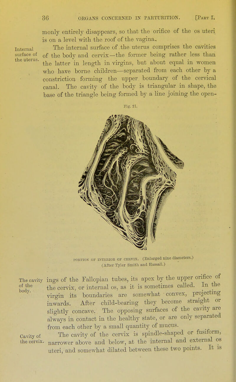 Internal surface of the uterus. monly entirely disappears, so that the orifice of the os uteri is on a level with the roof of the vagina. The internal surface of the uterus comprises the cavities of the body and cervix—the former being rather less than the latter in length in virgins, but about equal in women who have borne children—separated from each other by a constriction forming the upper boundary of the cervical canal. The cavity of the body is triangular in shape, the base of the triangle being formed by a line joining the open- Fig. 21. portion oi' interior of cervix. (Enlarged nine diameters.) (After Tyler Smith and Hassall.) The cavity ings of the Fallopian tubes, its apex by the upper orifice of of the body Xii^kJ «*-»w — - — J J.  - the cervix, or internal os. as it is sometimes called. In the virgin its boundaries are somewhat convex, projecting inwards. After child-bearing they become straight or slightly concave. The opposing surfaces of the cavity are always in contact in the healthy state, or are only separated from each other by a small quantity of mucus. Cavity of The cavity of the cervix is spindle-shaped or fusiform, the cervix. narroWer above and below, at the internal and external os uteri, and somewhat dilated between these two points. It is