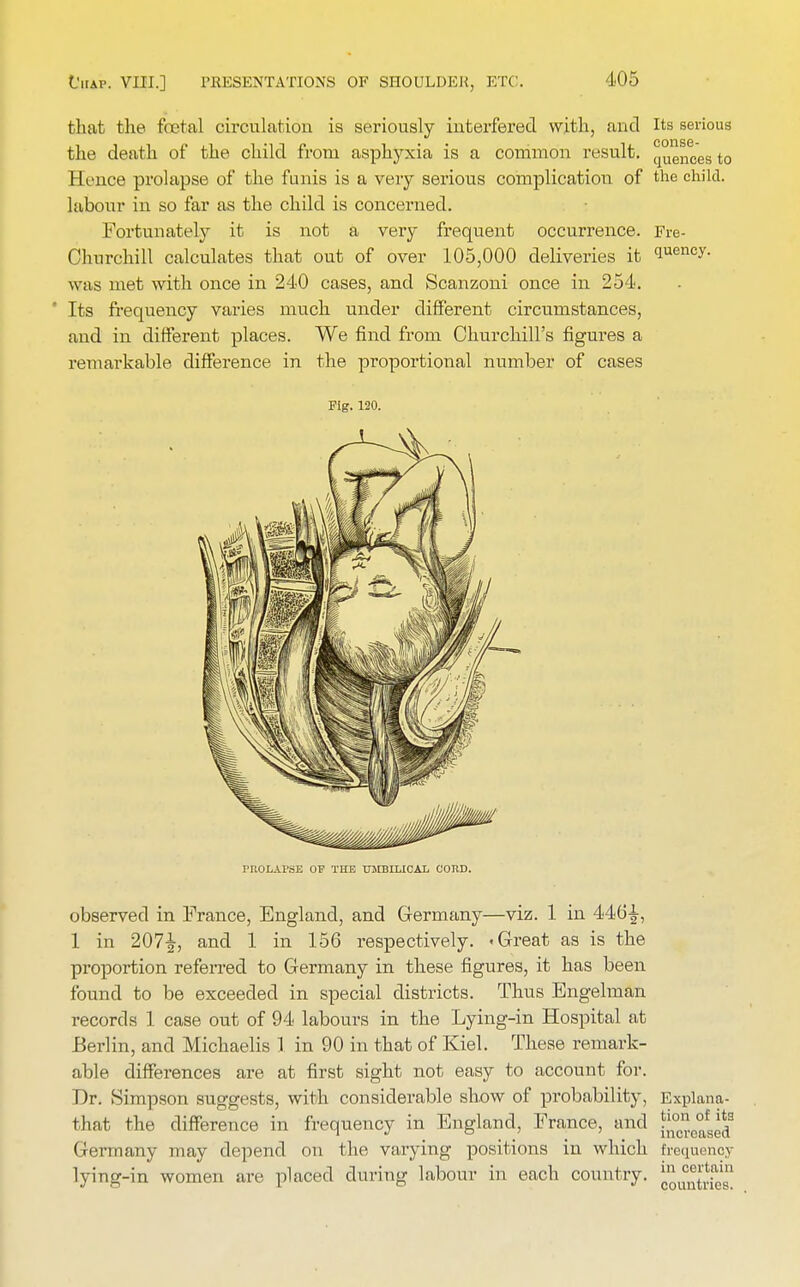 that the foetal circulation is seriously interfered with, and Its serious the death of the child from asphyxia is a common result, quinces to Hence prolapse of the funis is a very serious complication of the child, labour in so far as the child is concerned. Fortunately it is not a very frequent occurrence. Fre- Chnrchill calculates that out of over 105,000 deliveries it W™*- vyas met with once in 240 cases, and Scanzoni once in 254. ' Its frequency varies much under different circumstances, and in different places. We find from Churchill's figures a remarkable difference in the proportional number of cases Fig. 120. PROLAPSE OP THE UMBILICAL COIID. observed in France, England, and Germany—viz. 1 in 446^, 1 in 207-^, and 1 in 156 respectively. .Great as is the proportion referred to Germany in these figures, it has been found to be exceeded in special districts. Thus Engelman records 1 case out of 94 labours in the Lying-in Hospital at Berlin, and Michaelis 1 in 90 in that of Kiel. These remark- able differences are at first sight not easy to account for. Dr. Simpson suggests, with considerable show of probability, Explana- that the difference in frequency in England, France, and [j™.e°f8(!d3 Germany may depend on the varying positions in which frequency lying-in women are placed during labour in each country. J,^1-